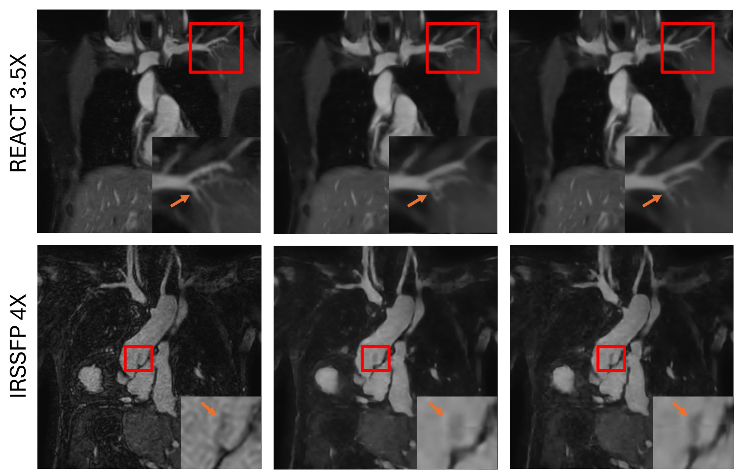 Bioengineering 12 00129 g004b