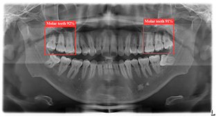Bioengineering 12 00134 i001