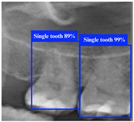 Bioengineering 12 00134 i002
