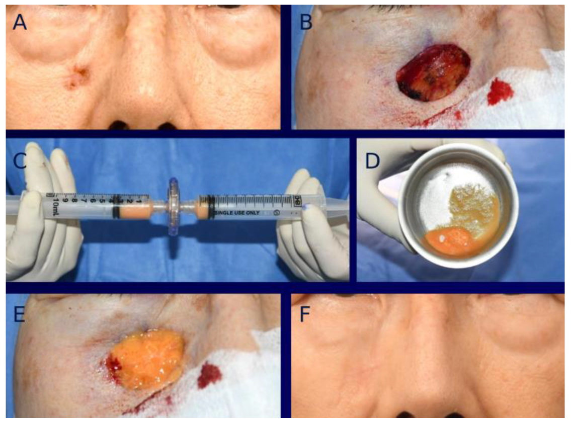 Bioengineering 12 00145 g001