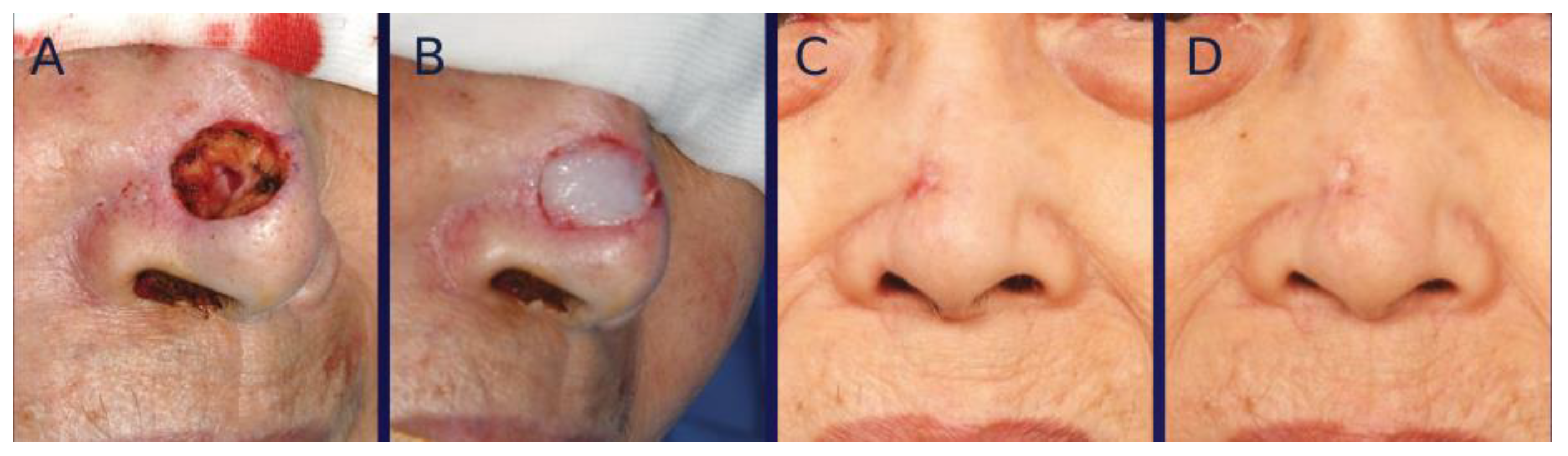 Bioengineering 12 00145 g005