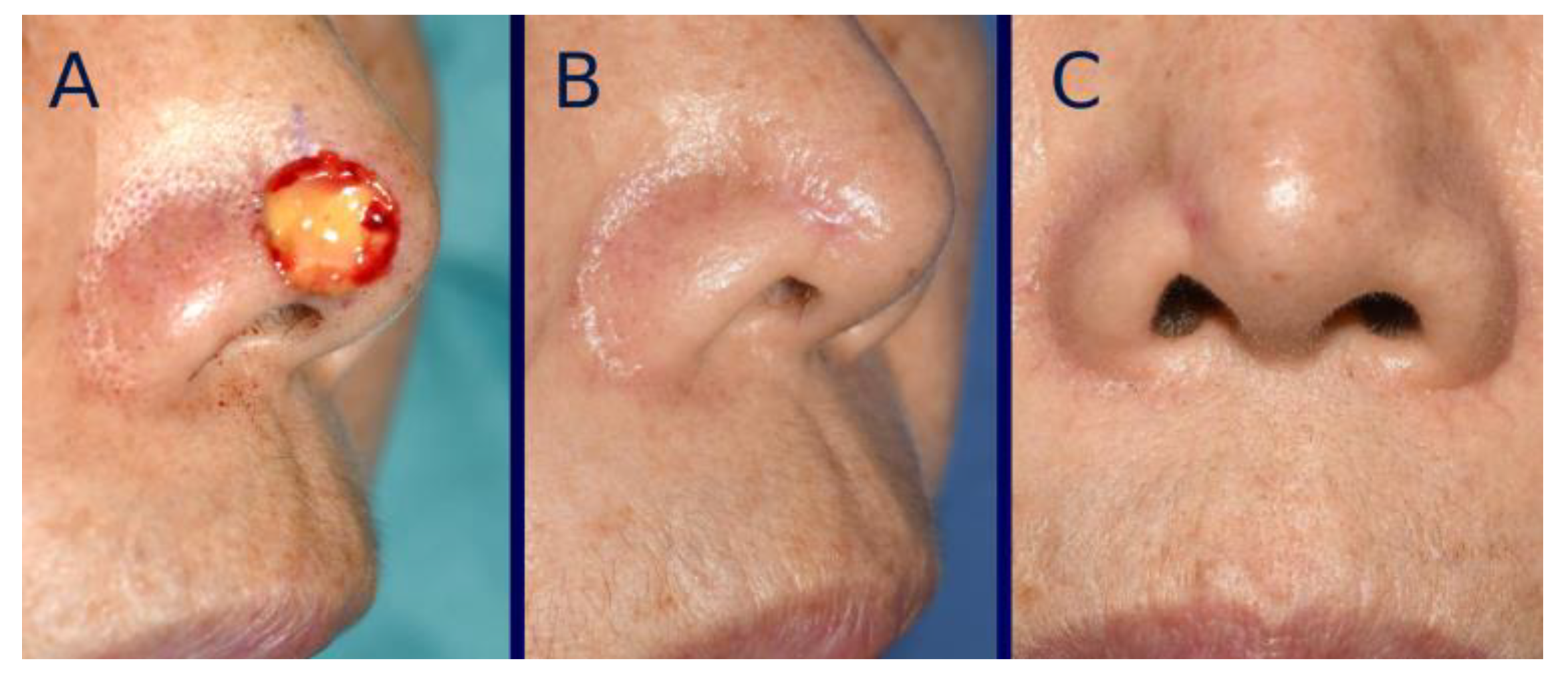 Bioengineering 12 00145 g007