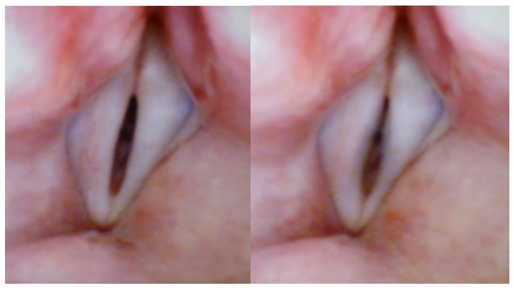 Bioengineering 12 00155 g003