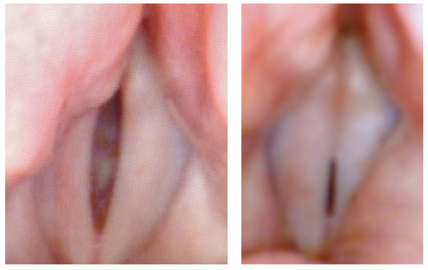 Bioengineering 12 00155 g005