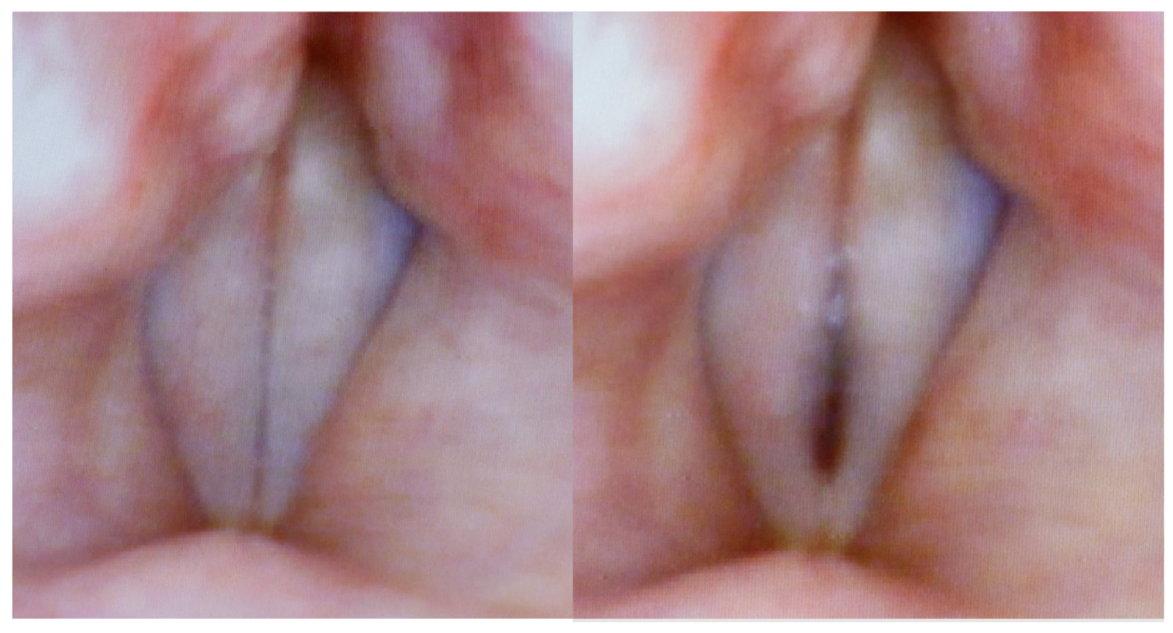 Bioengineering 12 00155 g006