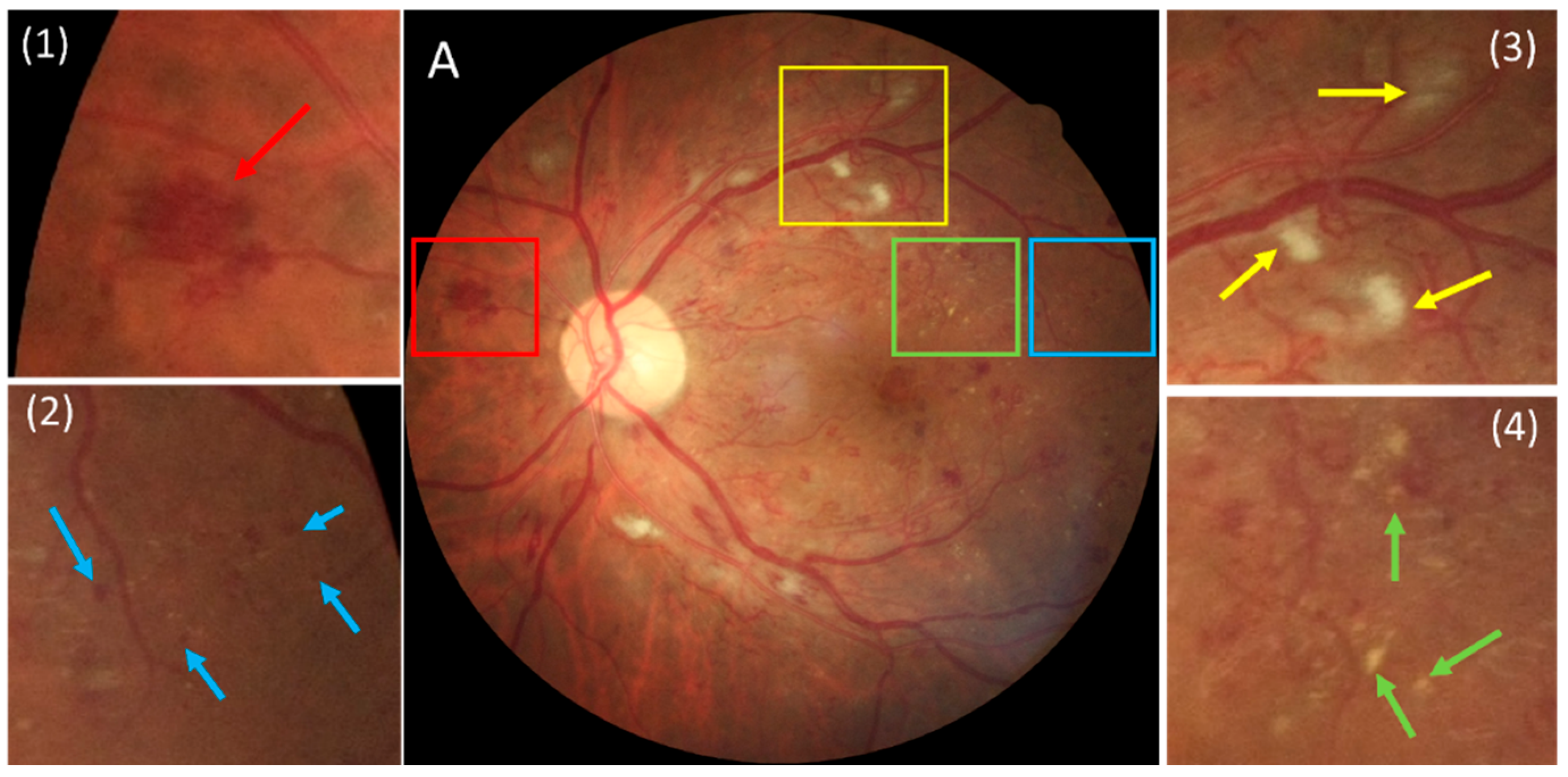 Bioengineering 12 00157 g001