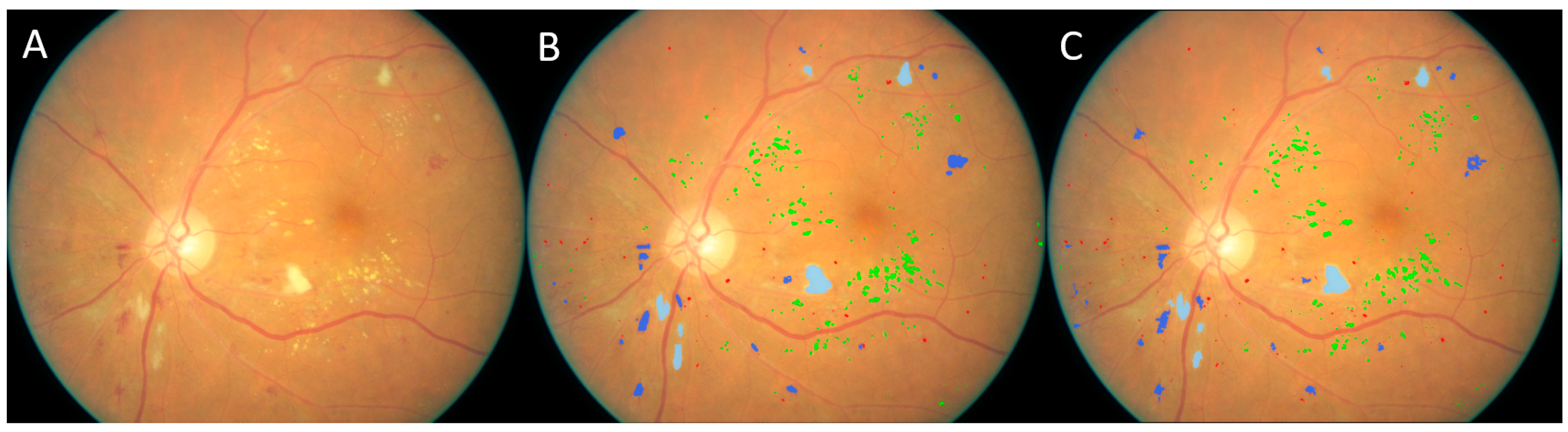 Bioengineering 12 00157 g007