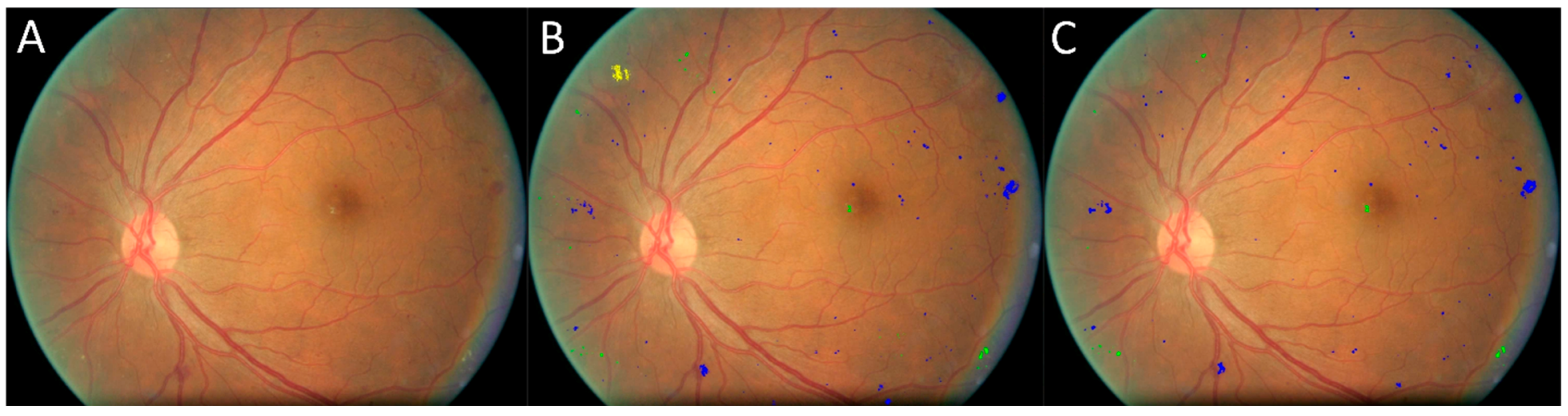 Bioengineering 12 00157 g009