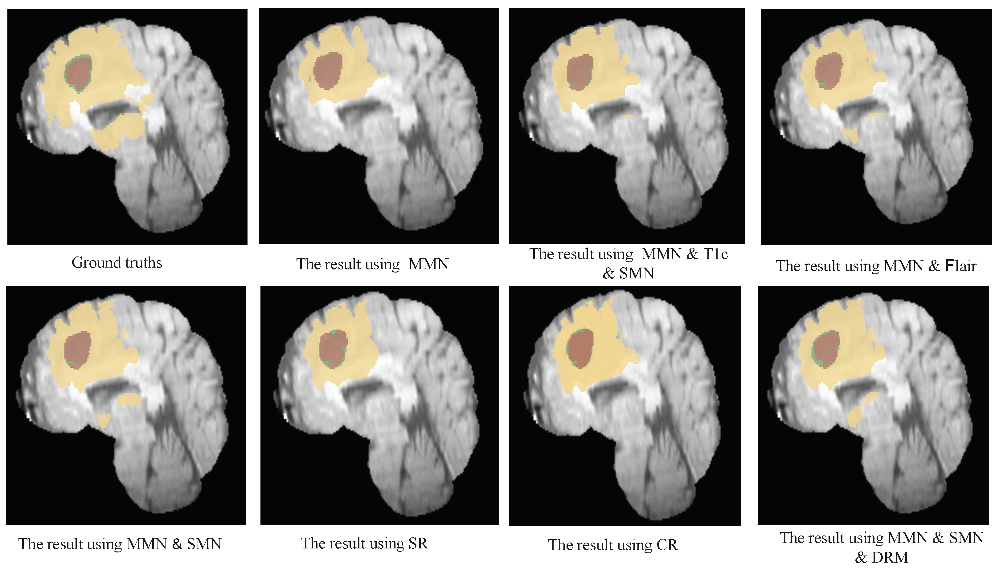 Bioengineering 12 00159 g006