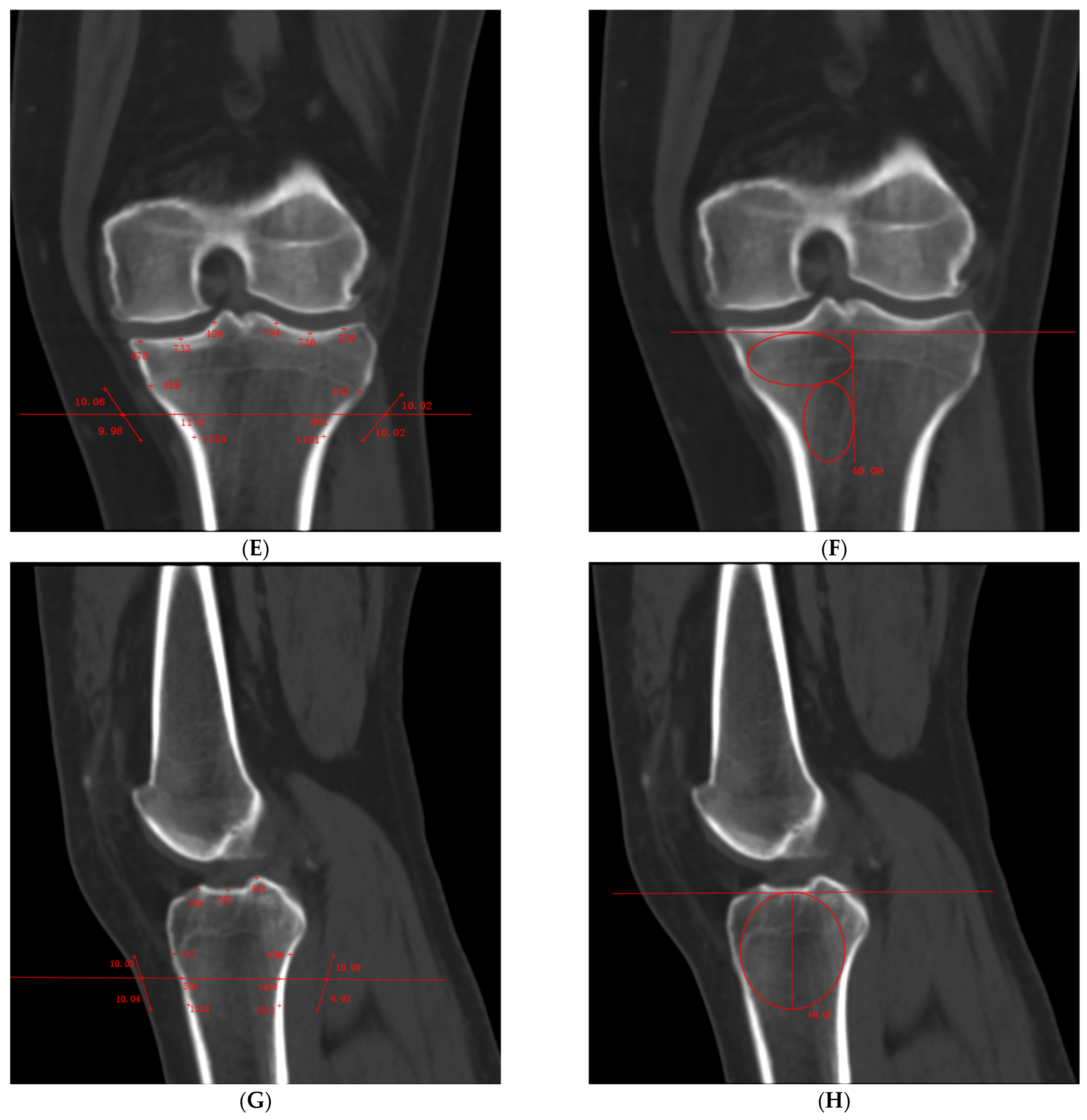 Bioengineering 12 00165 g002b
