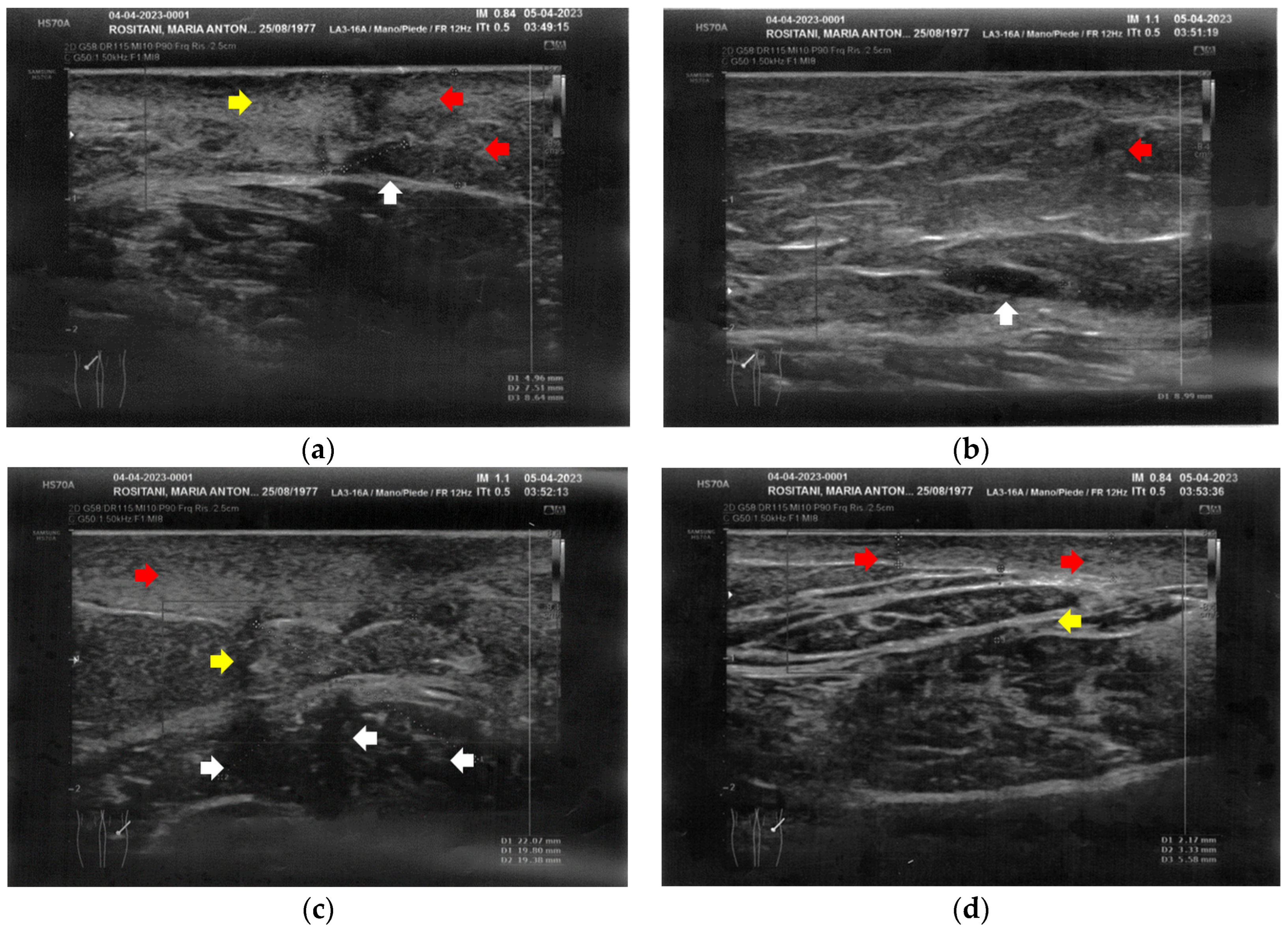 Bioengineering 12 00179 g003