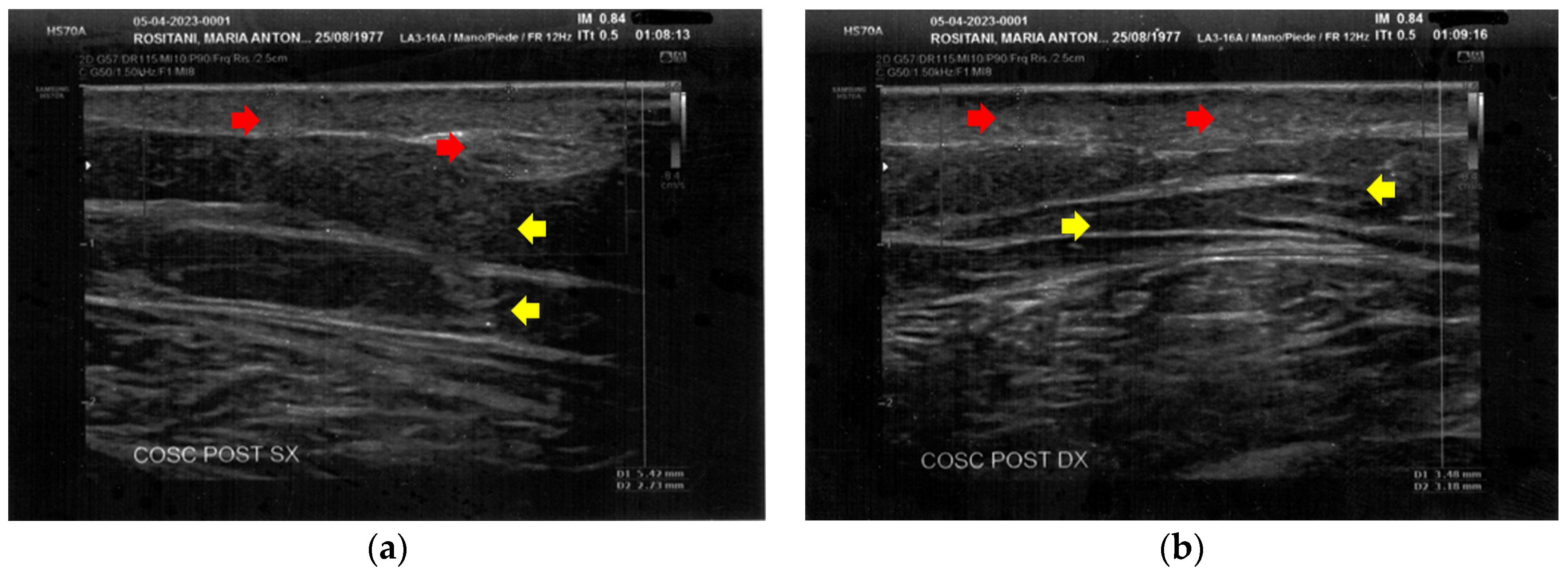 Bioengineering 12 00179 g005