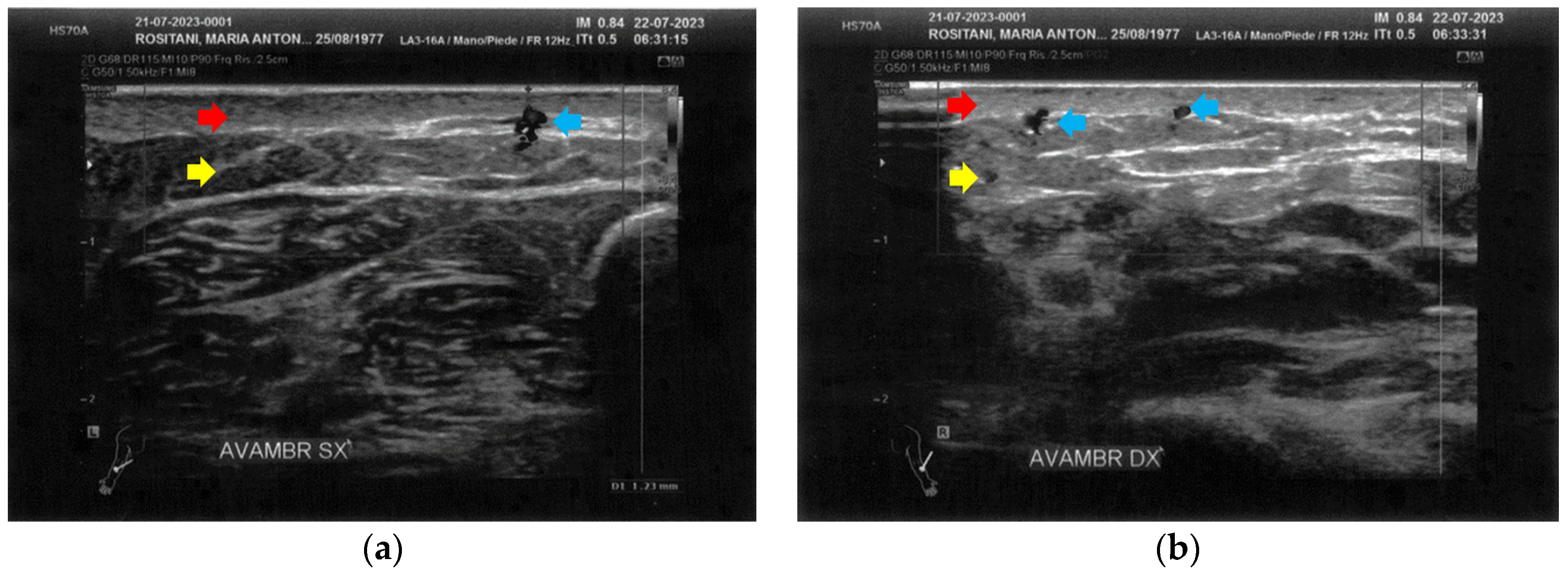 Bioengineering 12 00179 g006
