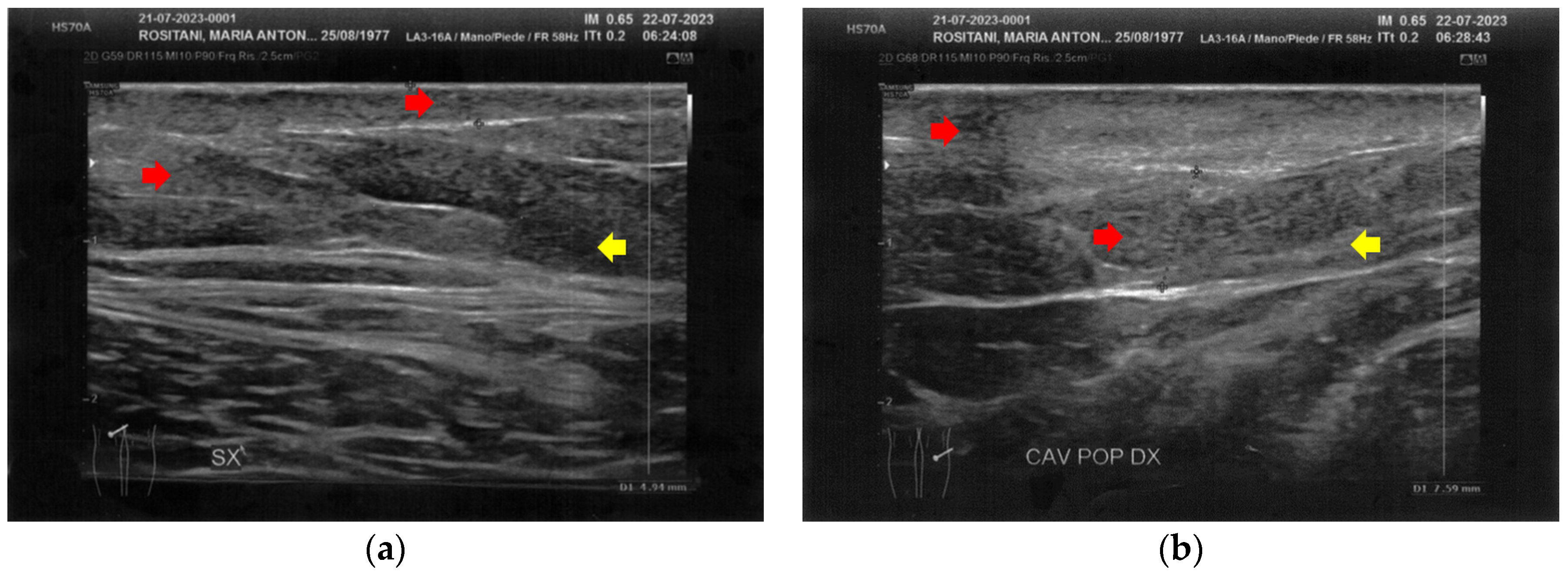 Bioengineering 12 00179 g007