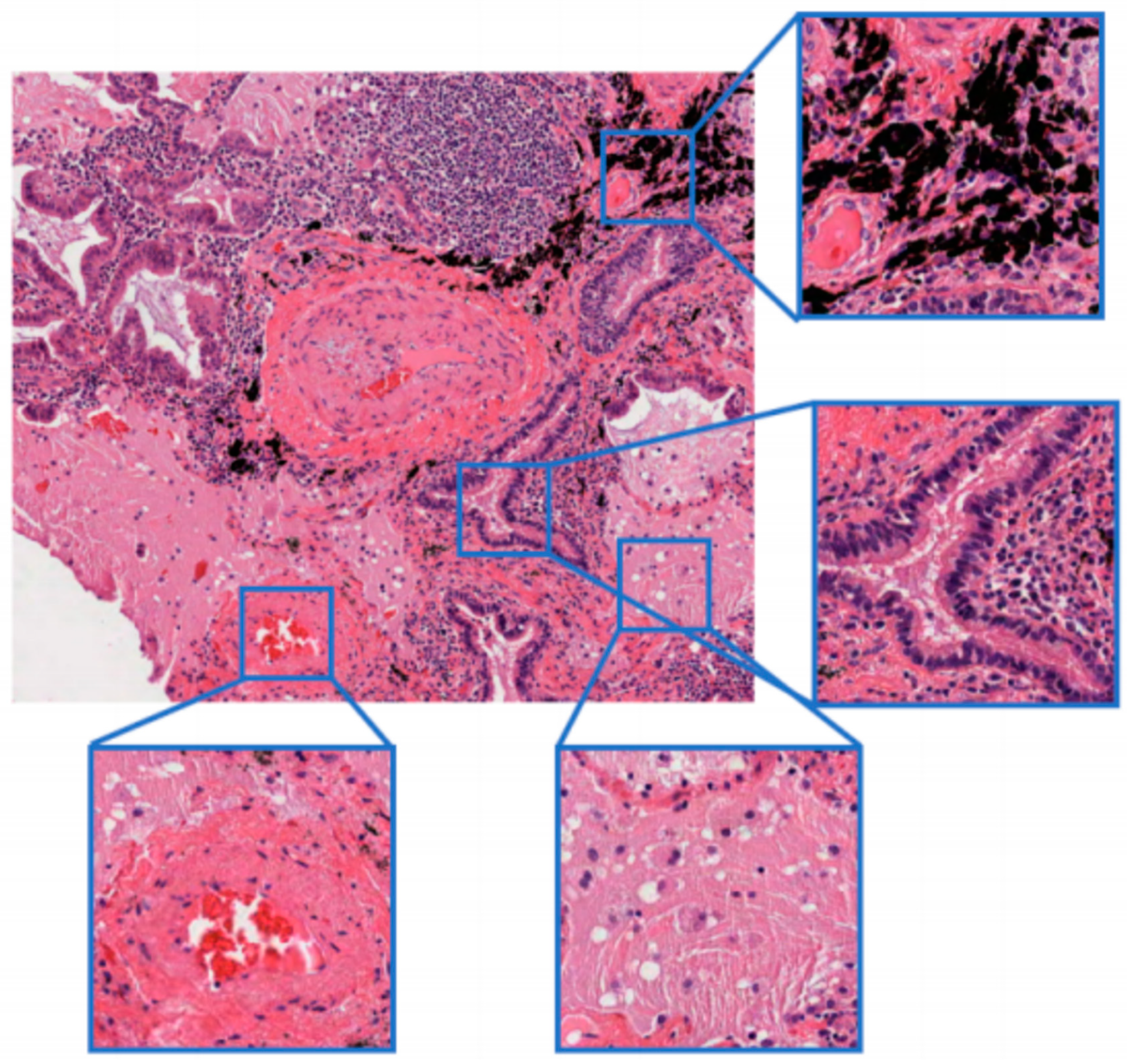 Bioengineering 12 00187 g001