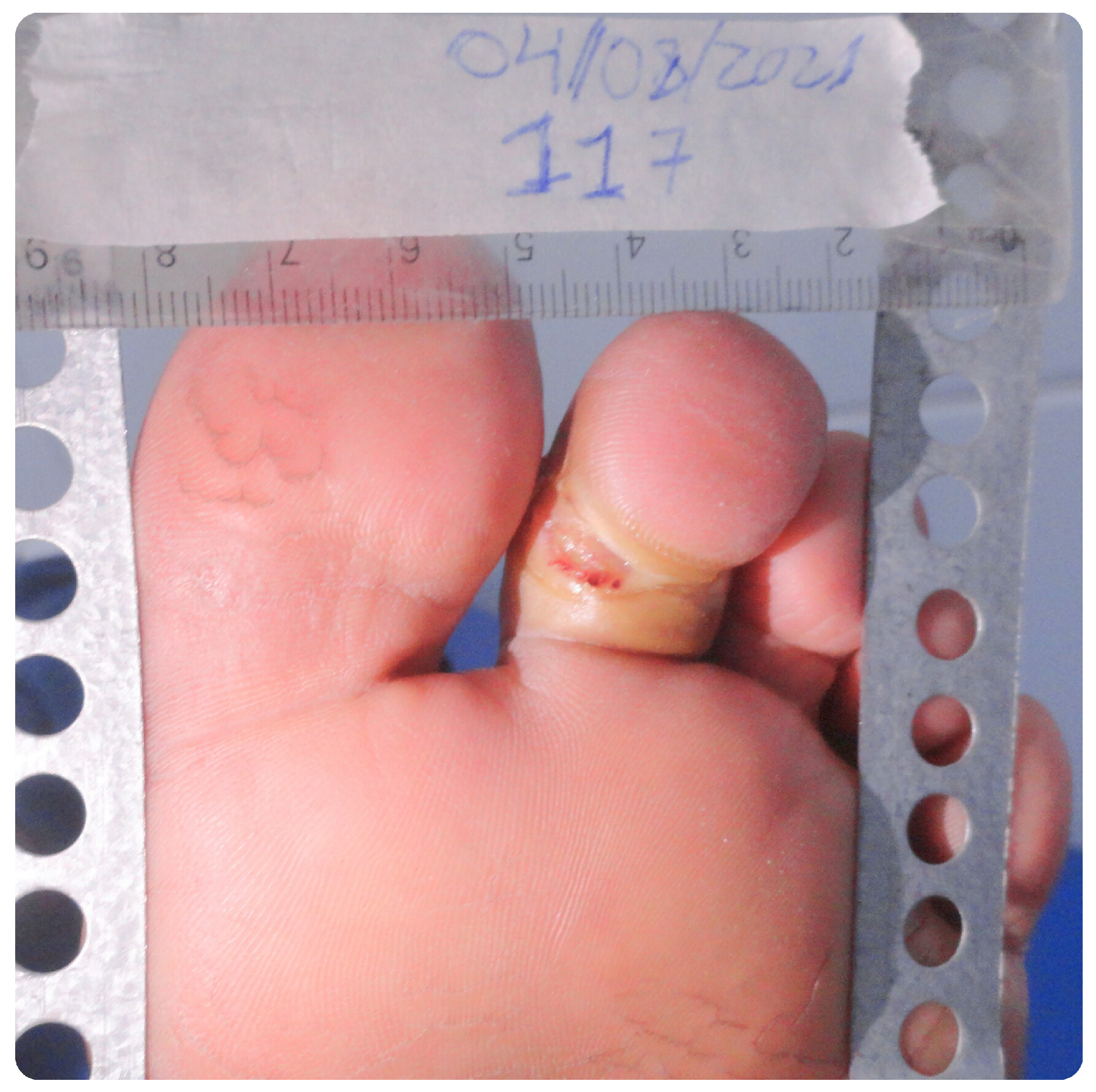 Bioengineering 12 00206 g006