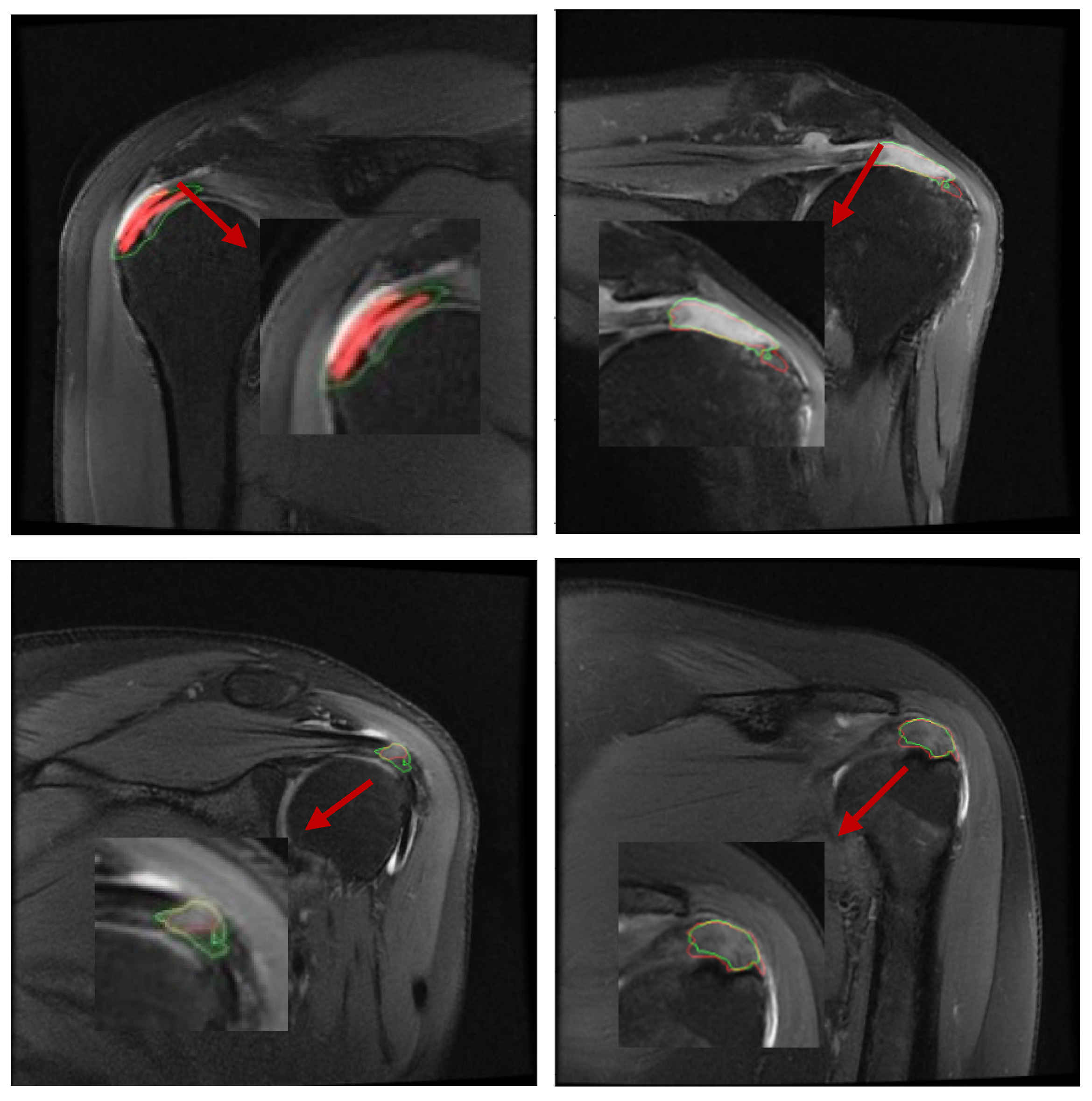 Bioengineering 12 00218 g004