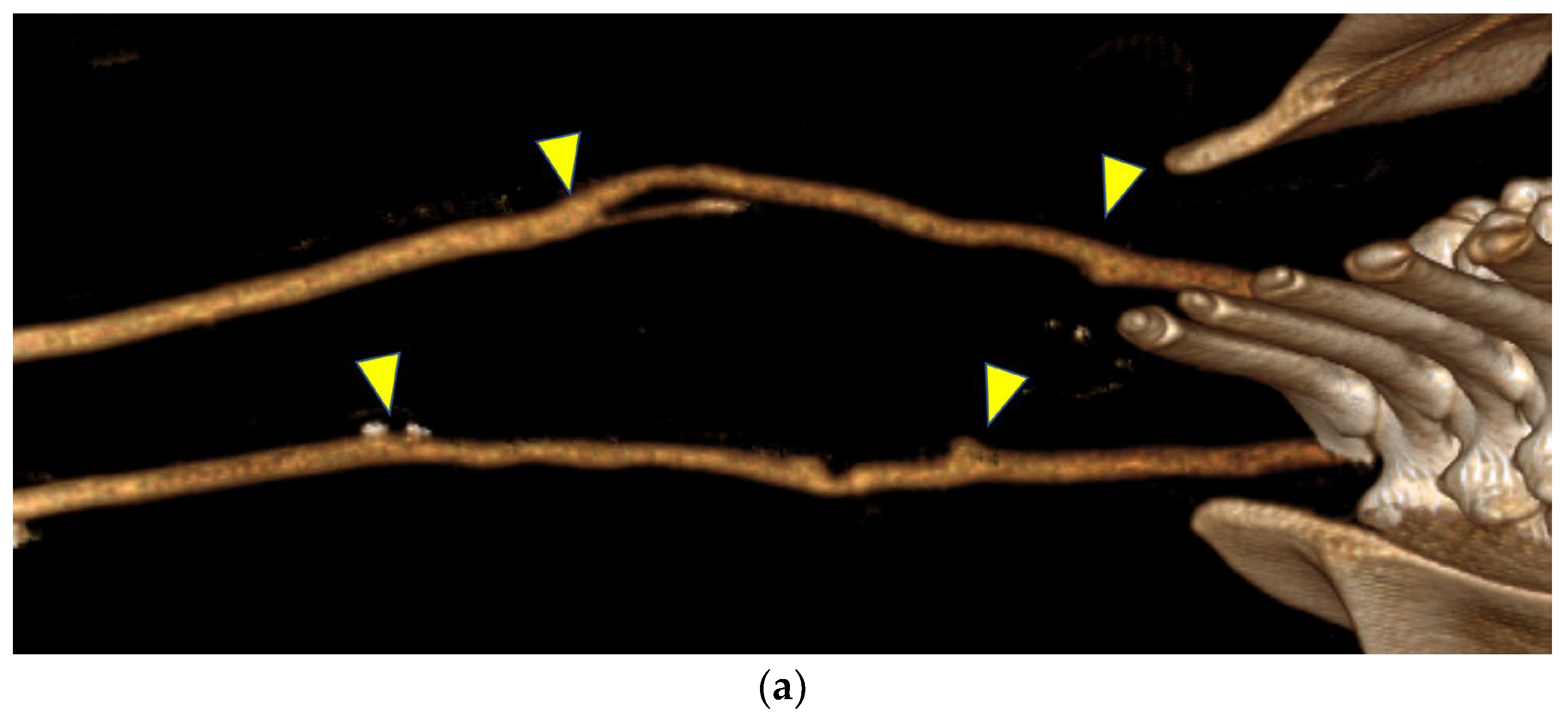 Bioengineering 12 00260 g005a