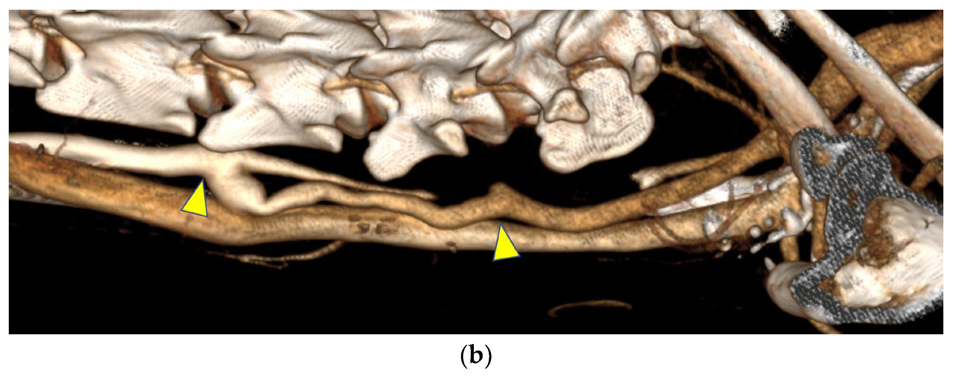 Bioengineering 12 00260 g005b