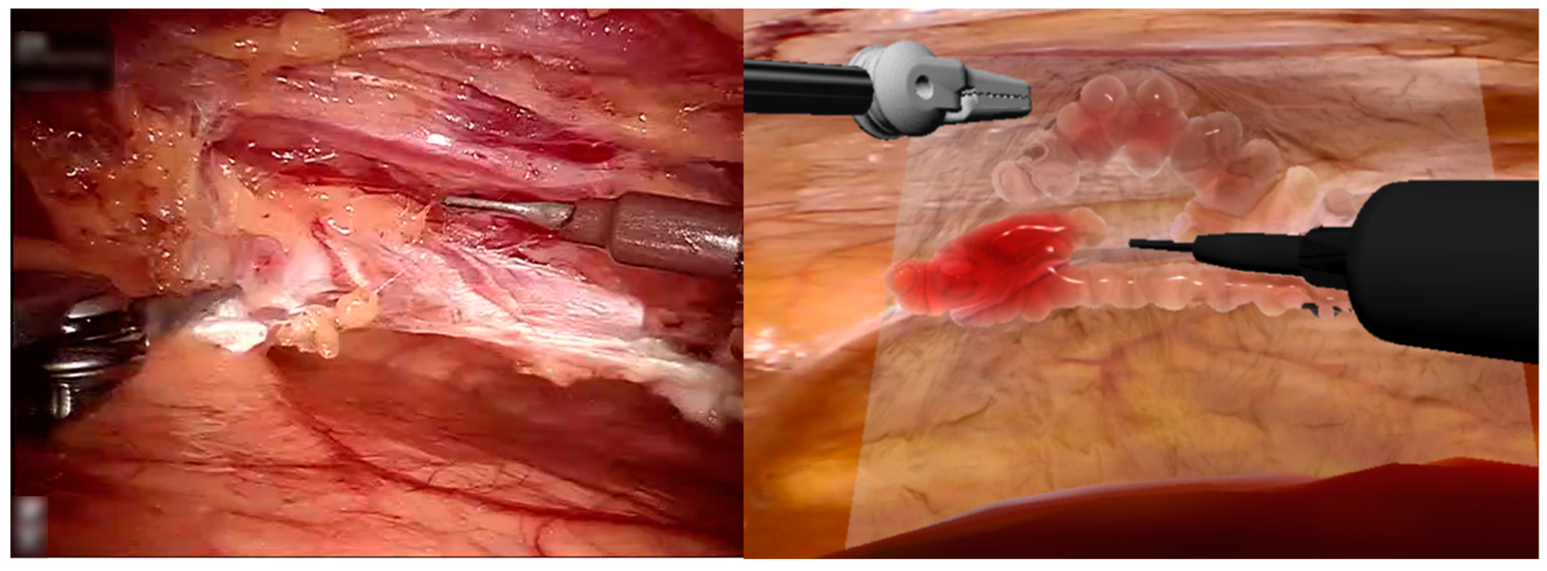 Bioengineering 12 00285 g003