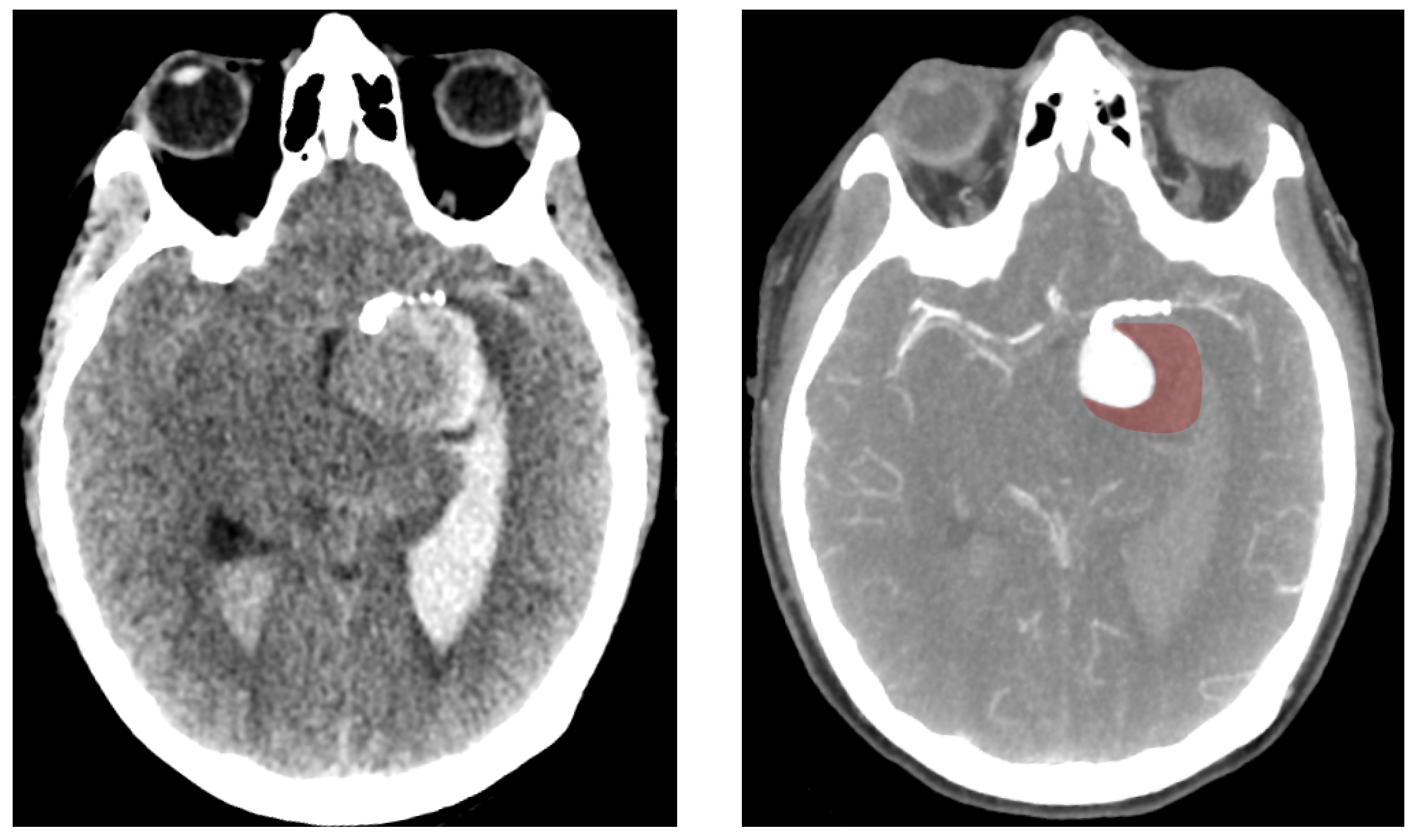 Bioengineering 12 00305 g008