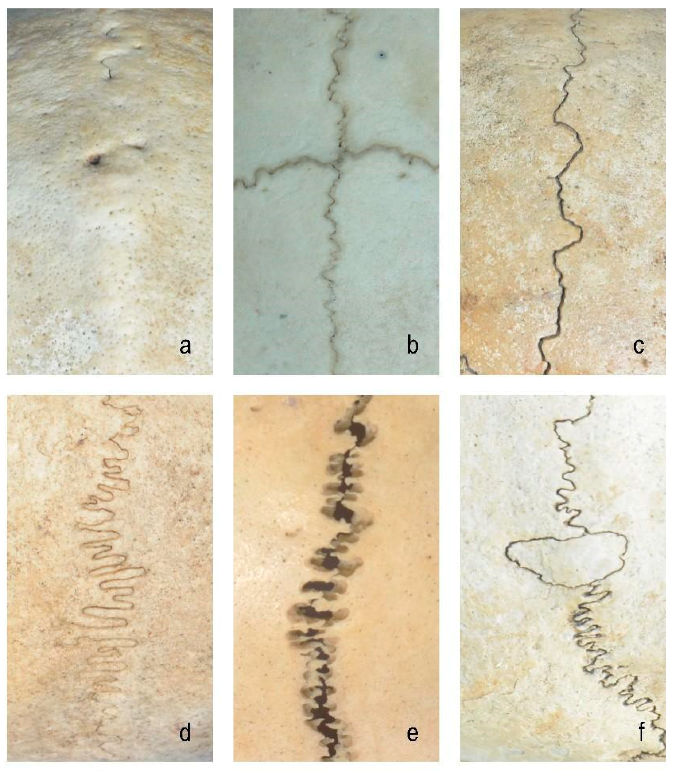 Bioengineering 12 00318 g001