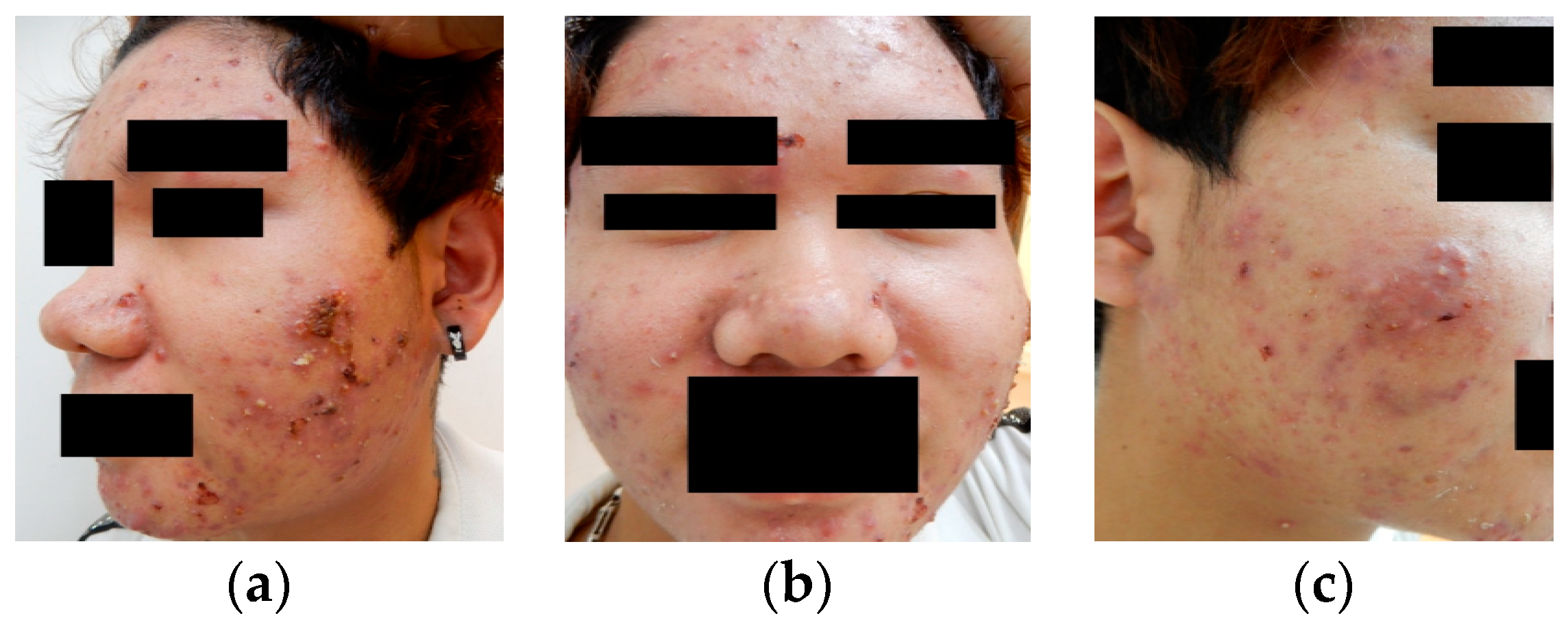 Bioengineering 12 00342 g007