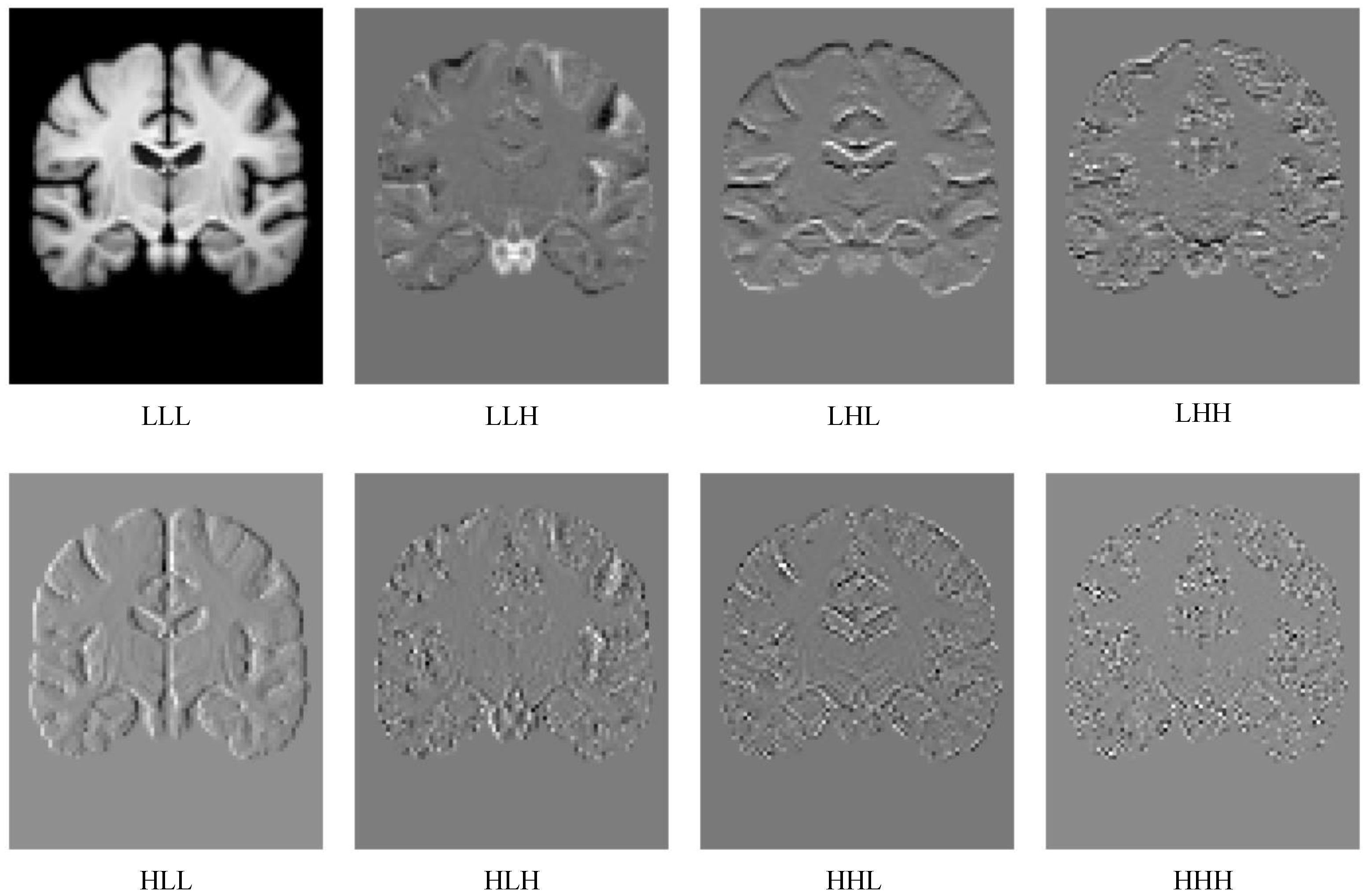 Wavelet-Guided Multi-Scale ConvNeXt for Unsupervised Medical