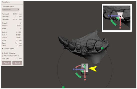 Digital Workflow with Open-Source CAD-CAM Software Aimed to Design a ...