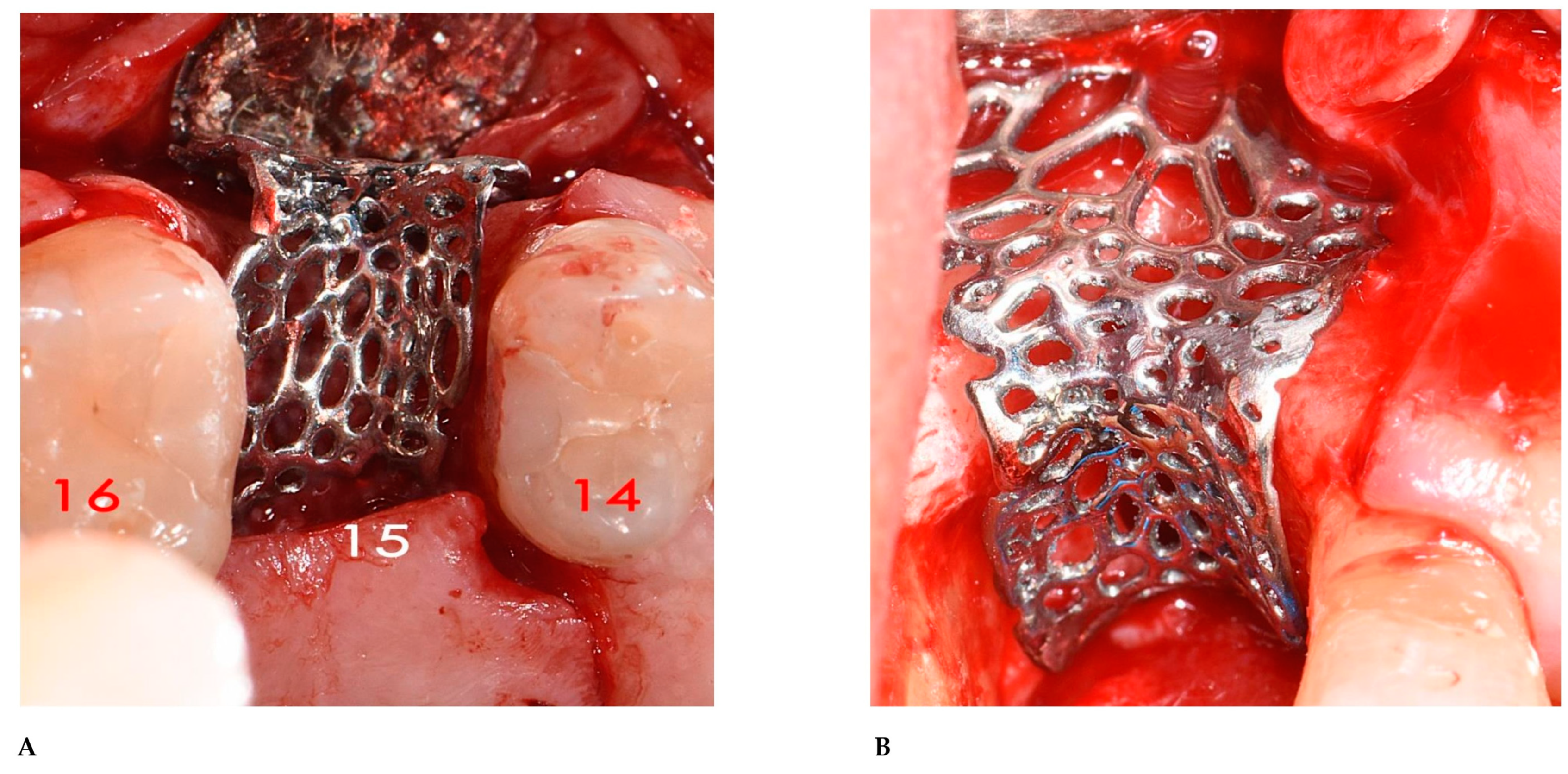 Bioengineering 12 00436 g016