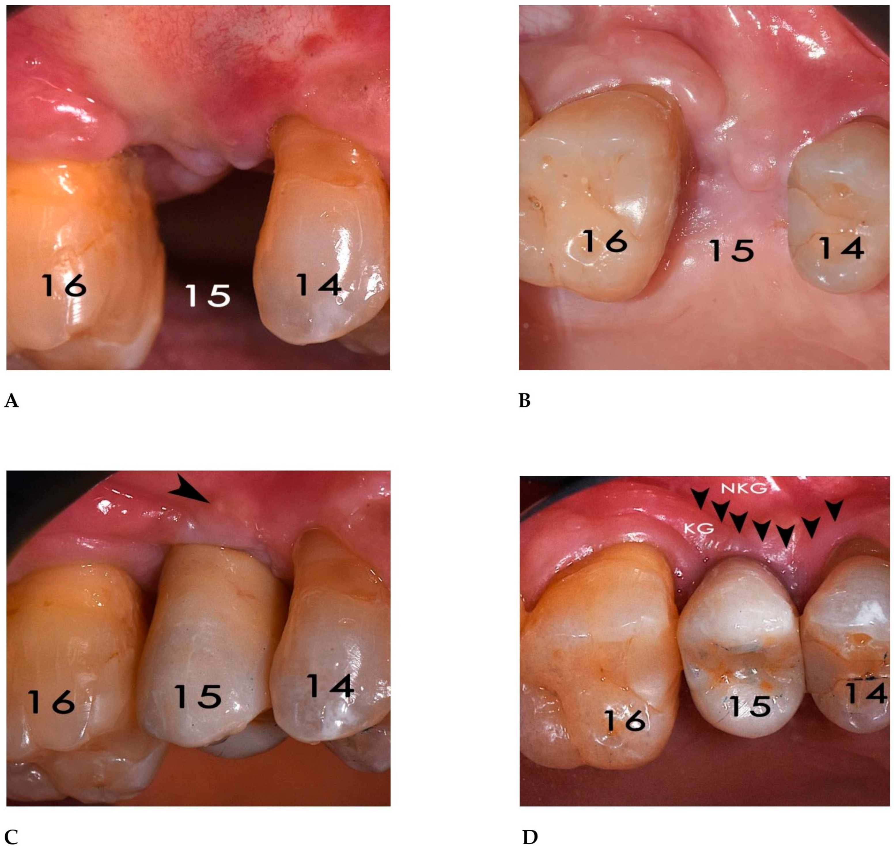 Bioengineering 12 00436 g018