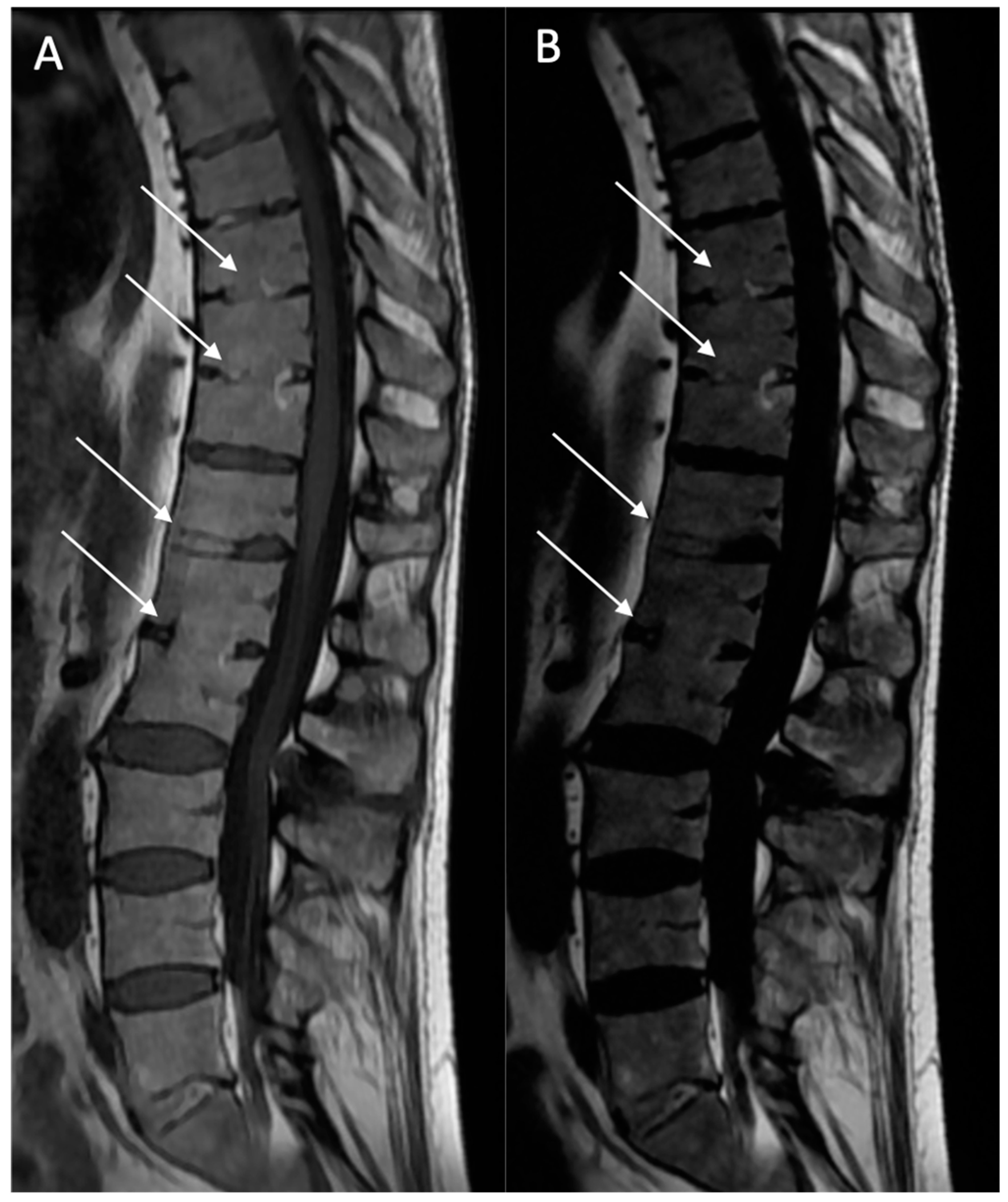 Bioengineering 12 00502 g005