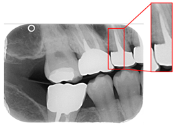 Bioengineering 12 00533 i002