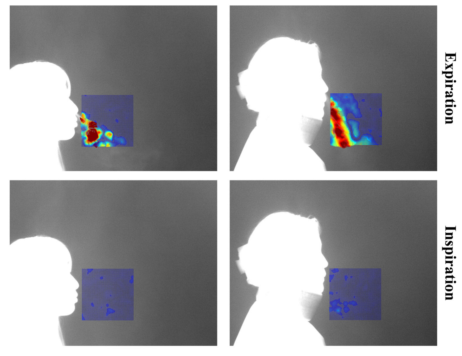 Bioengineering 12 00542 g004