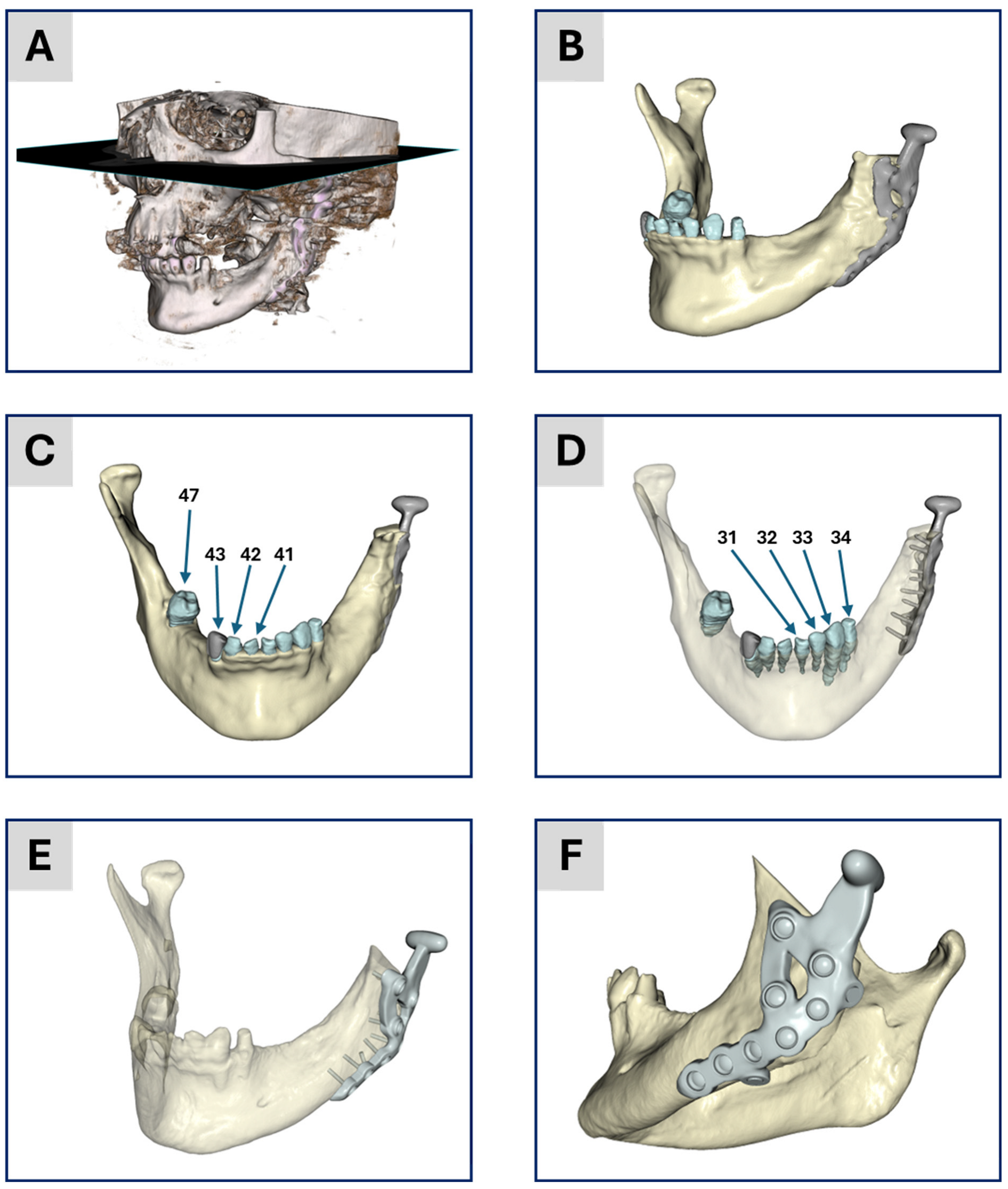 Bioengineering 12 00545 g001