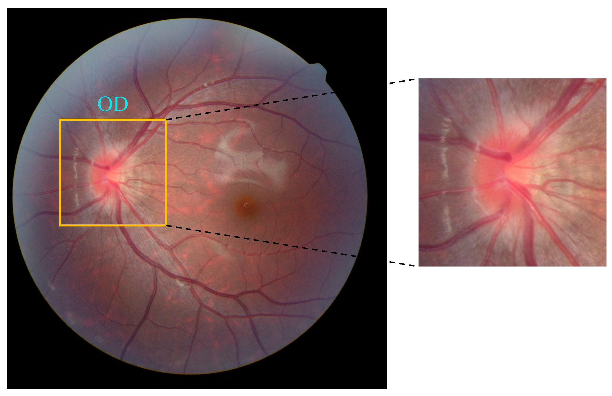 Bioengineering 12 00550 g012