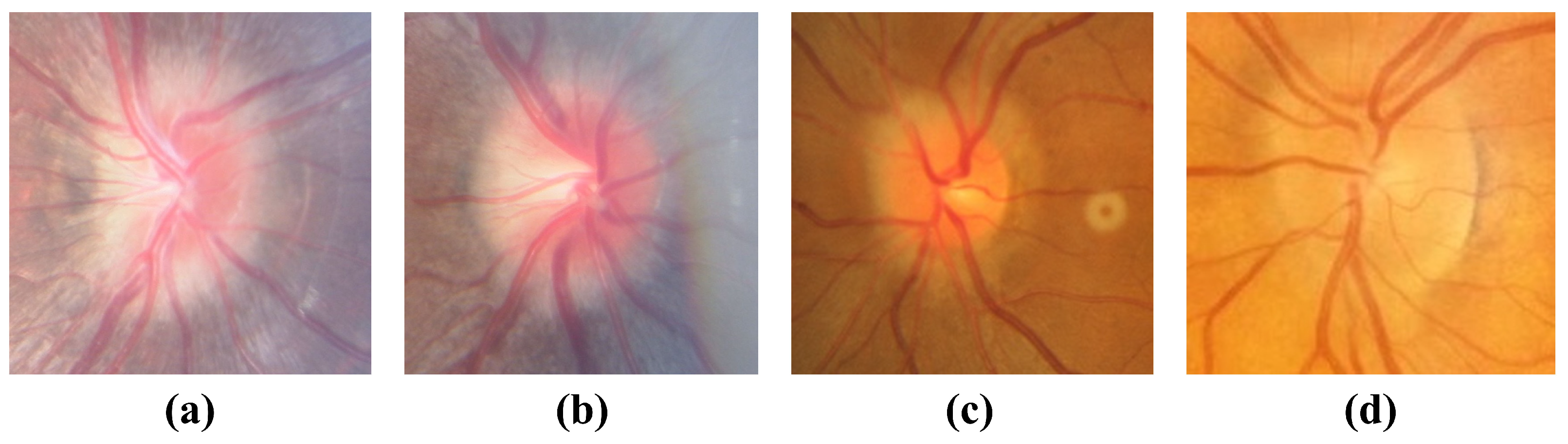 Bioengineering 12 00550 g015