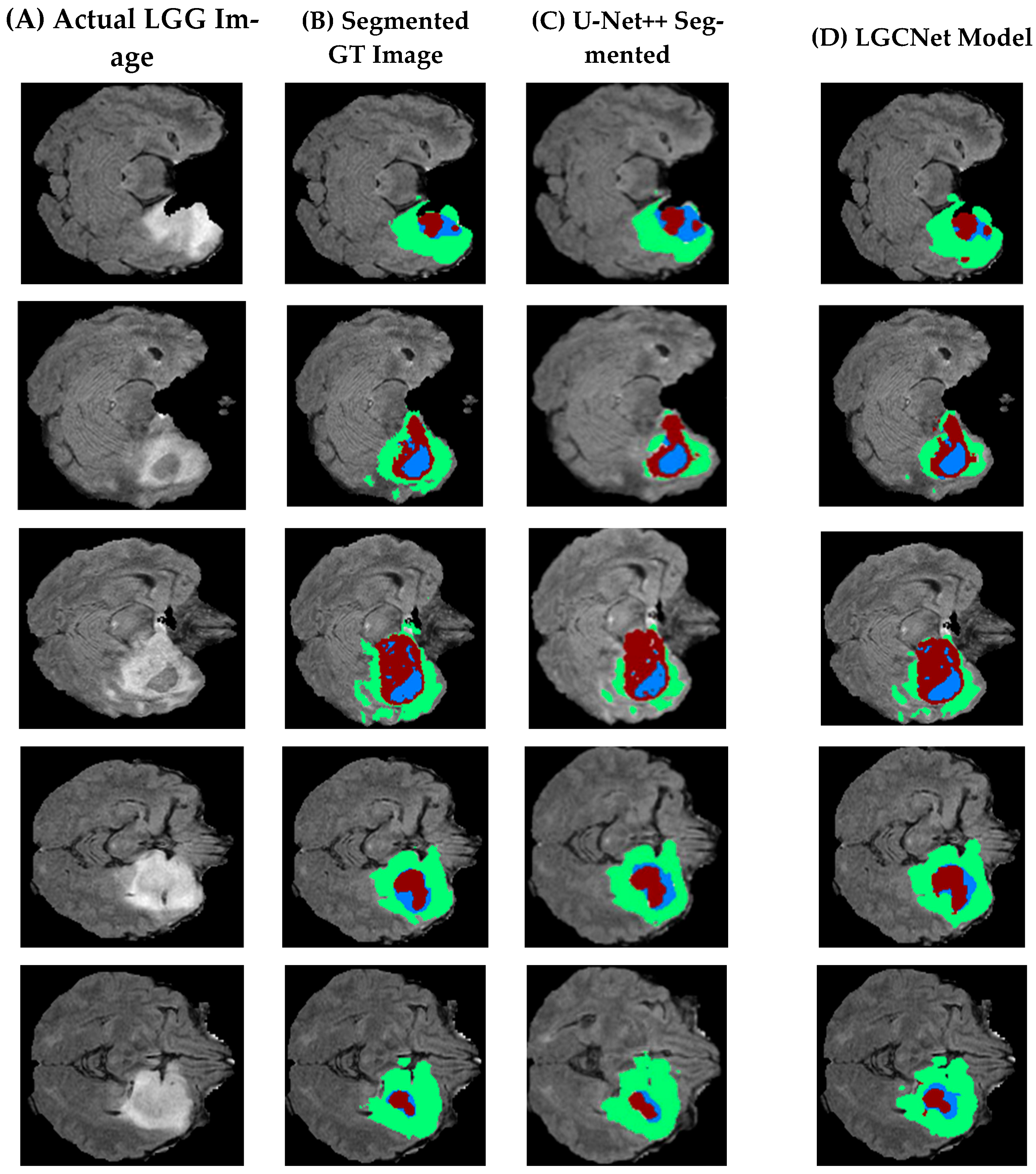 Bioengineering 12 00552 g009