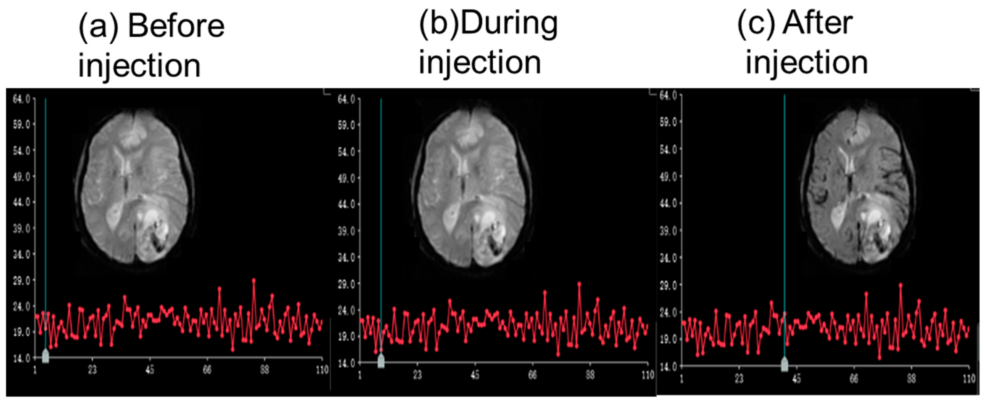 Bioengineering 12 00566 g008