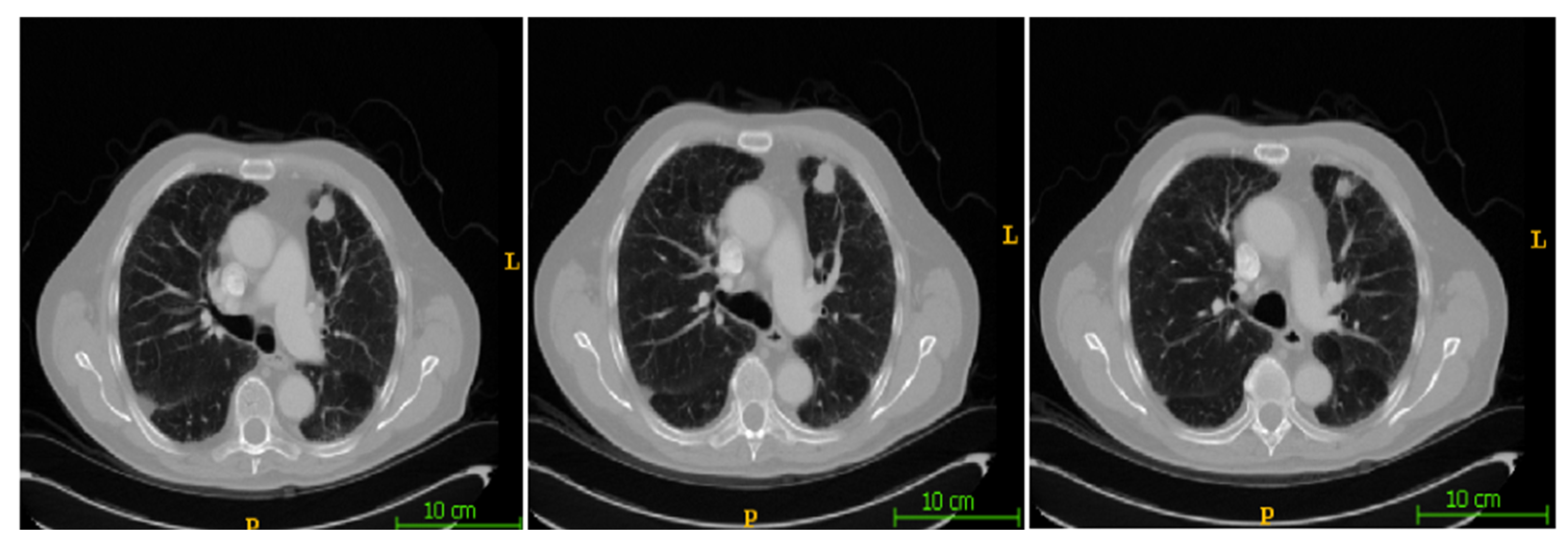 Bioengineering 12 00576 g006