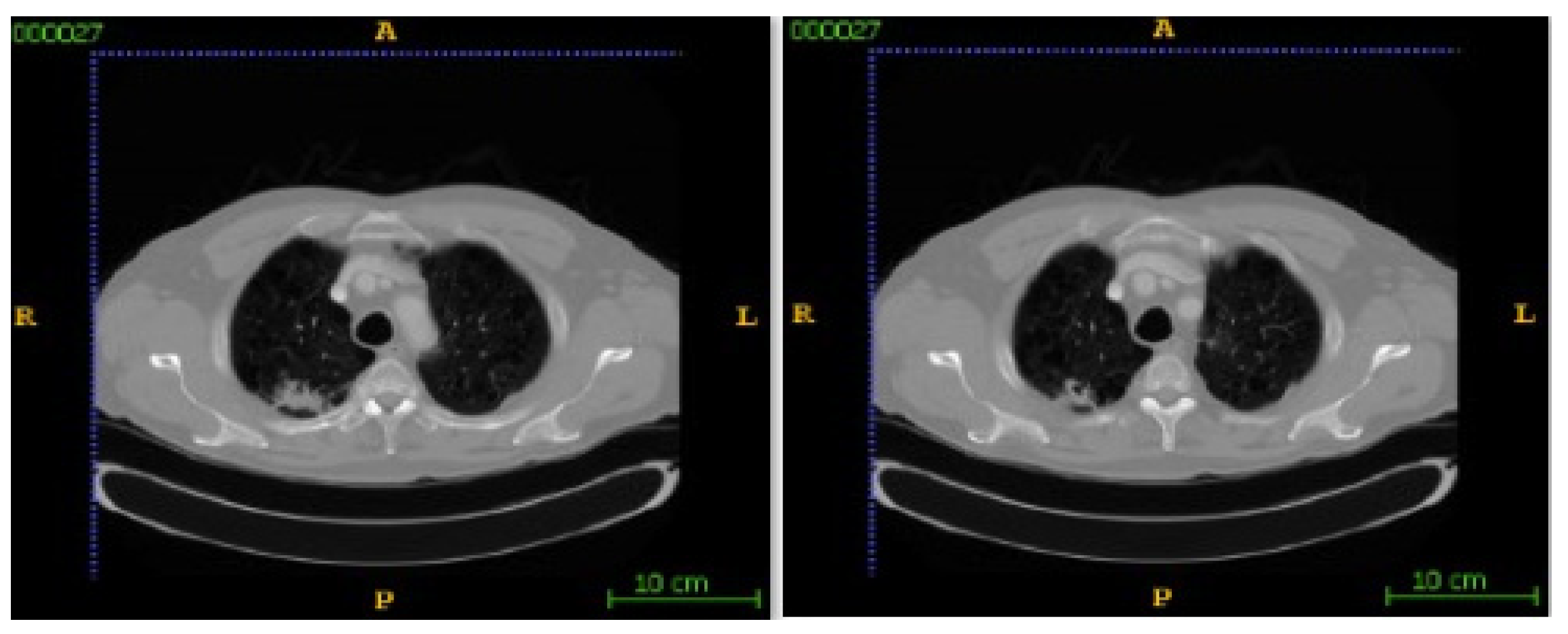 Bioengineering 12 00576 g008