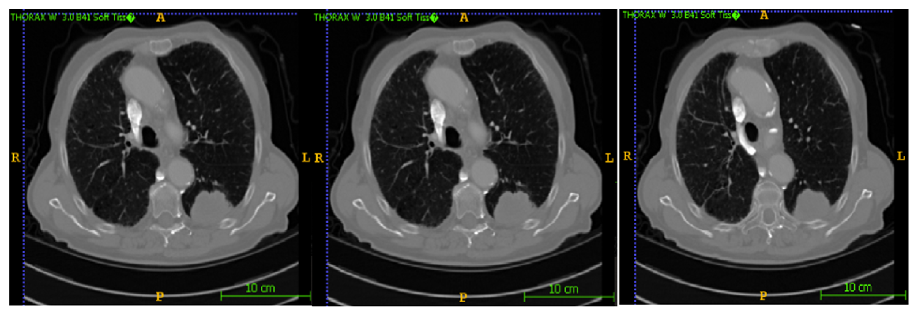 Bioengineering 12 00576 g010