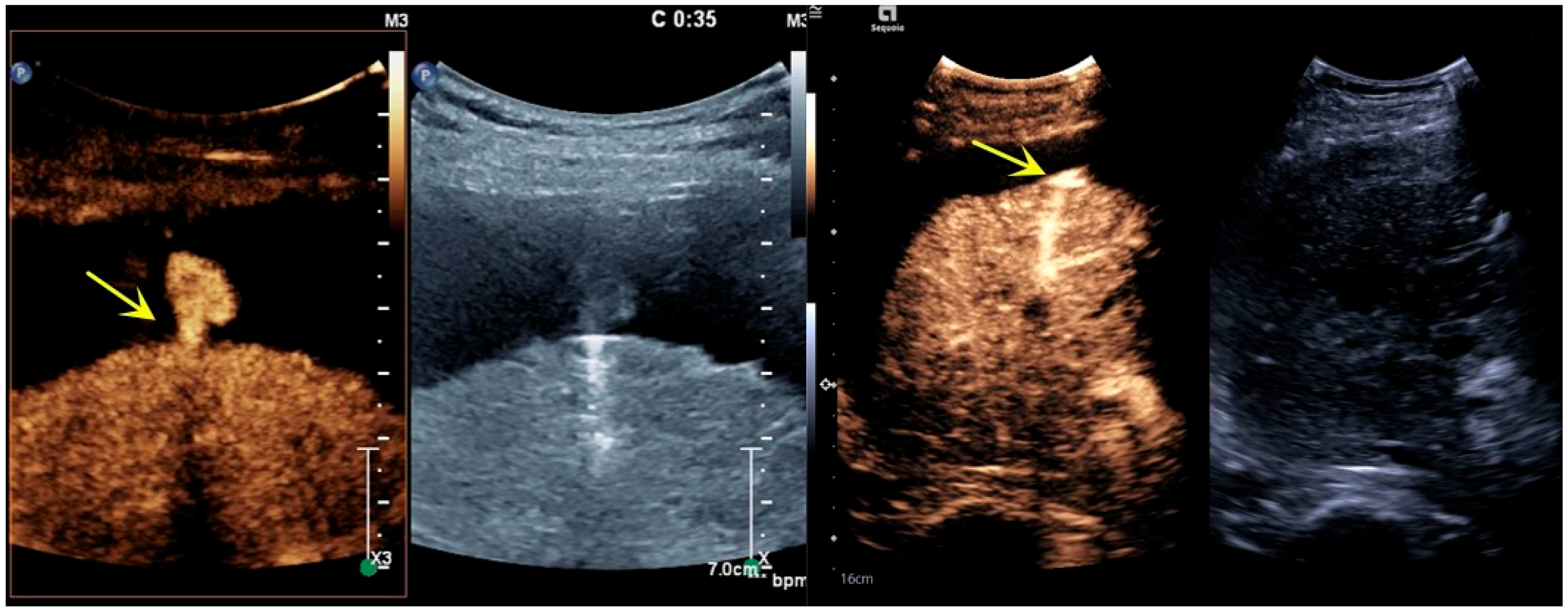 Bioengineering 12 00584 g002