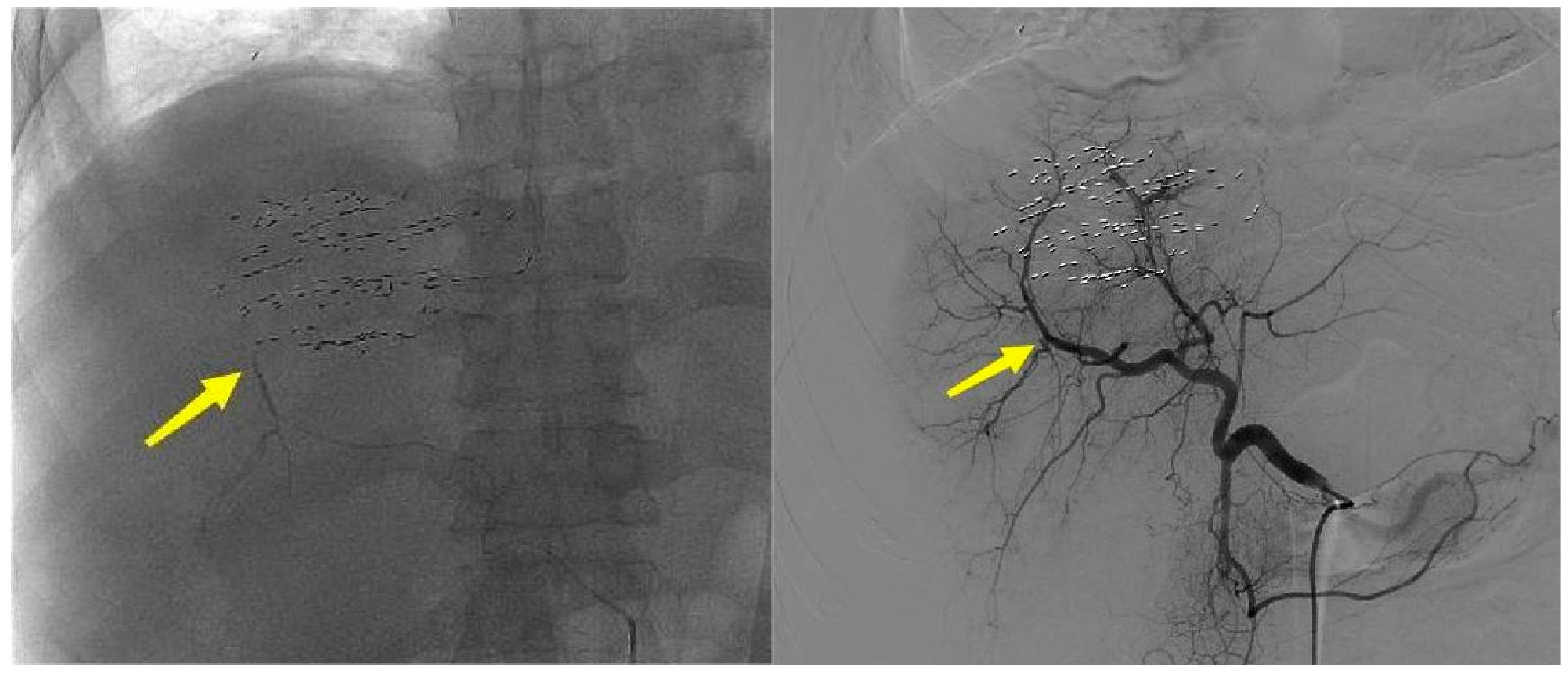 Bioengineering 12 00584 g004