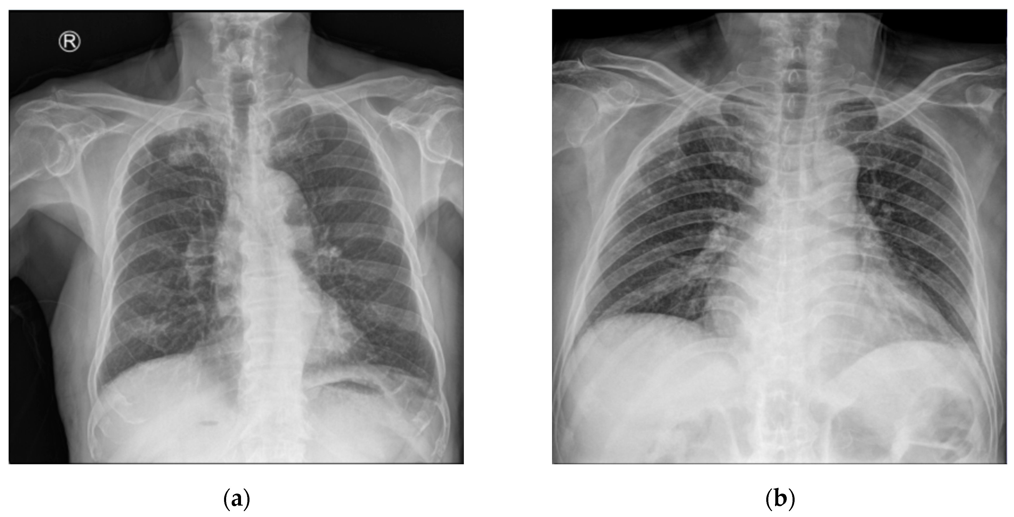Bioengineering 12 00630 g006a