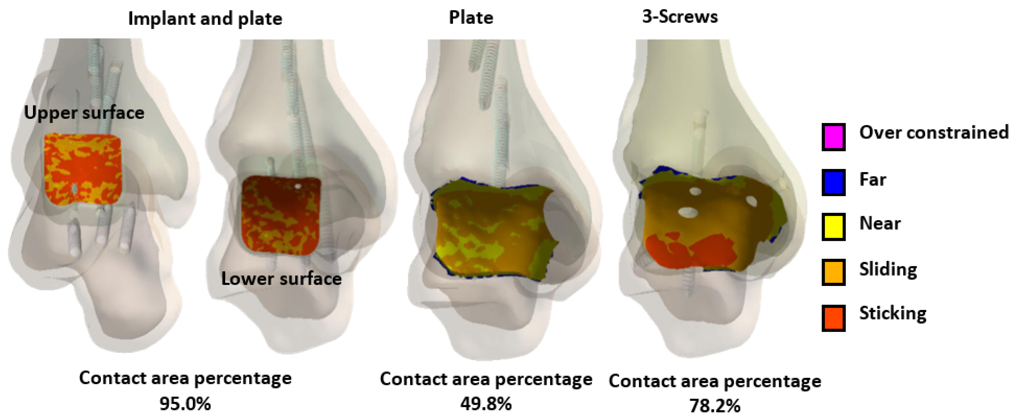 Bioengineering 12 00705 g011