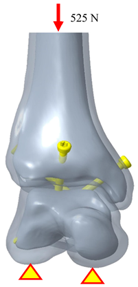 Bioengineering 12 00705 i001