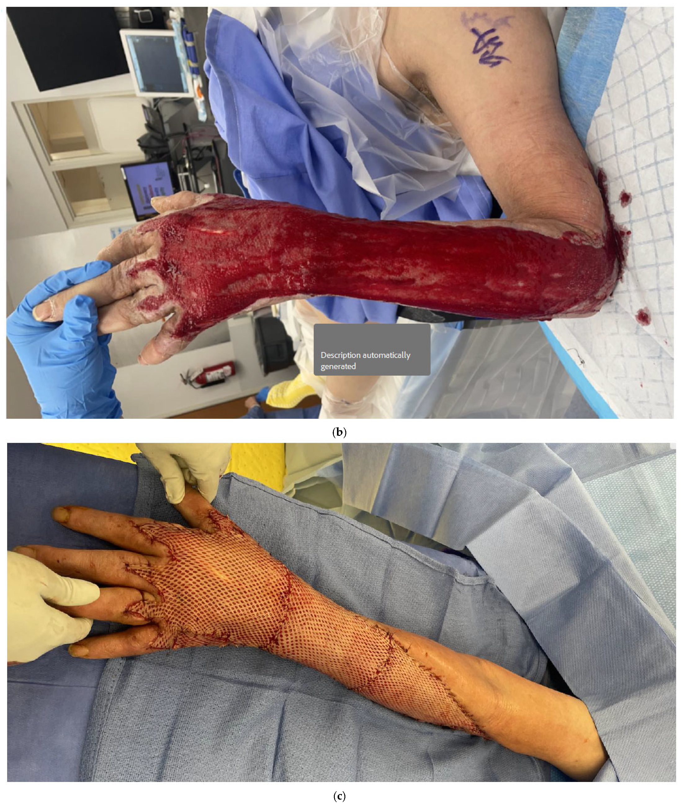 Bioengineering 12 00718 g001b