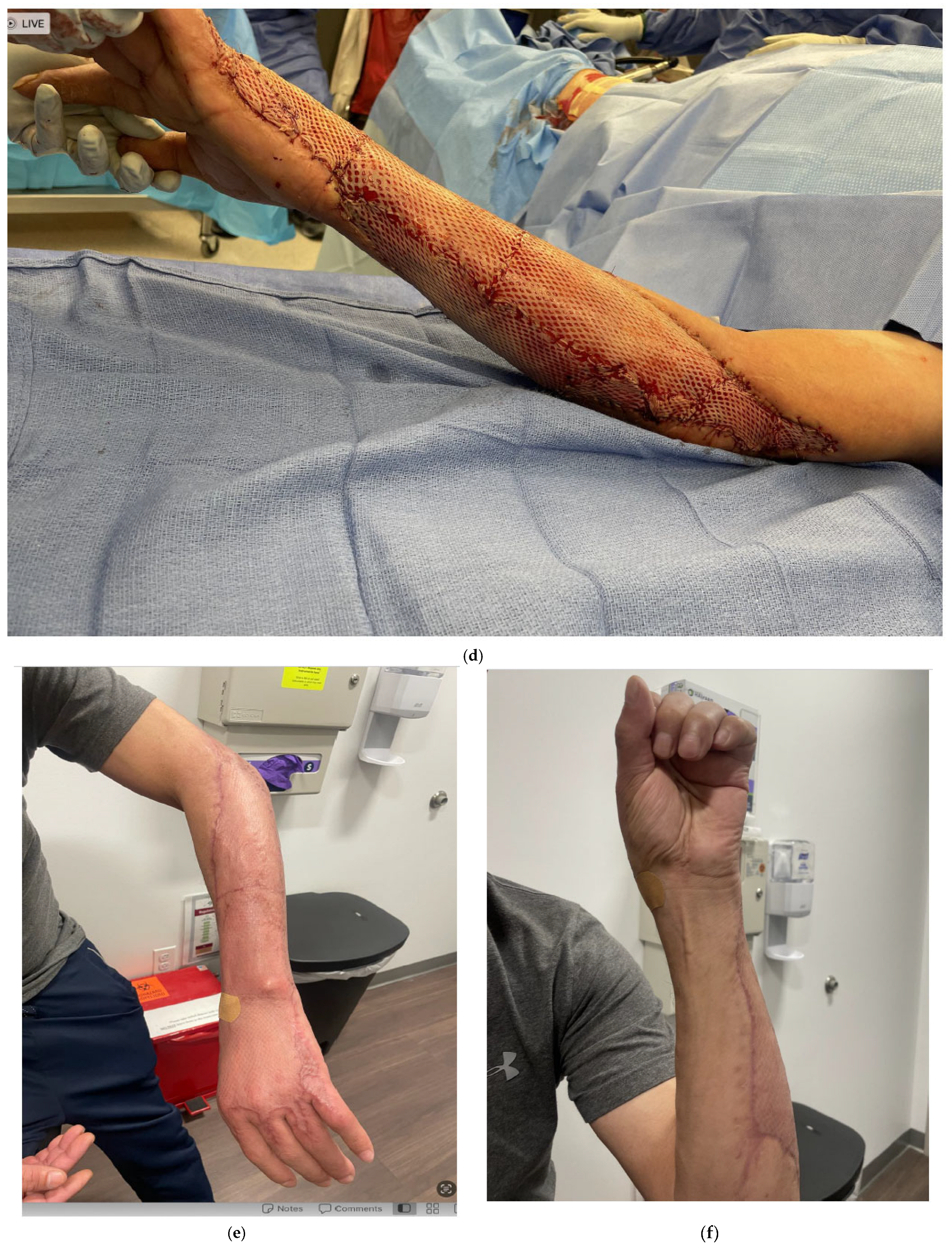 Bioengineering 12 00718 g001c