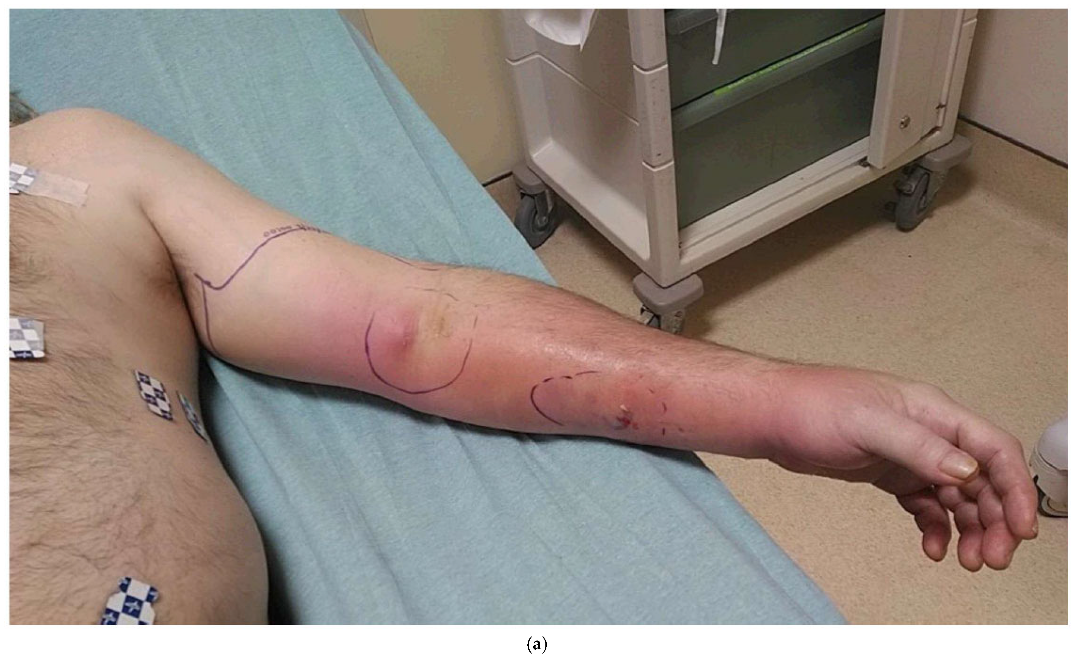 Bioengineering 12 00718 g002a